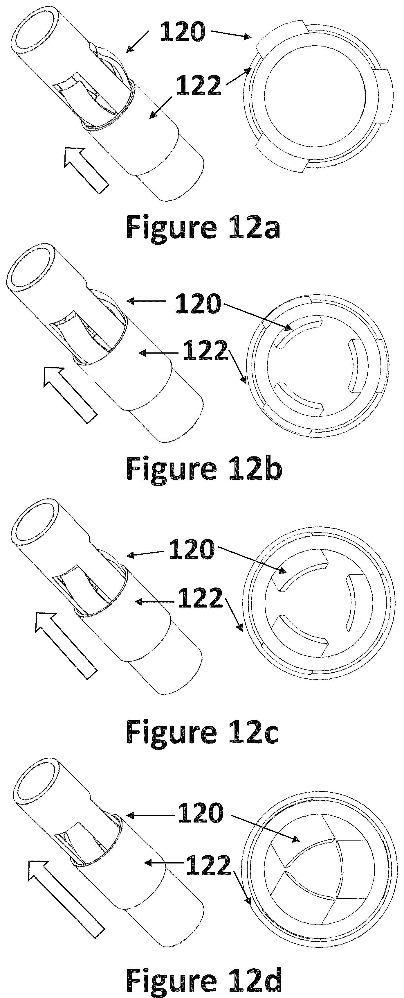 Patent US12318116 Figure 17 – Cardiac lead extraction device