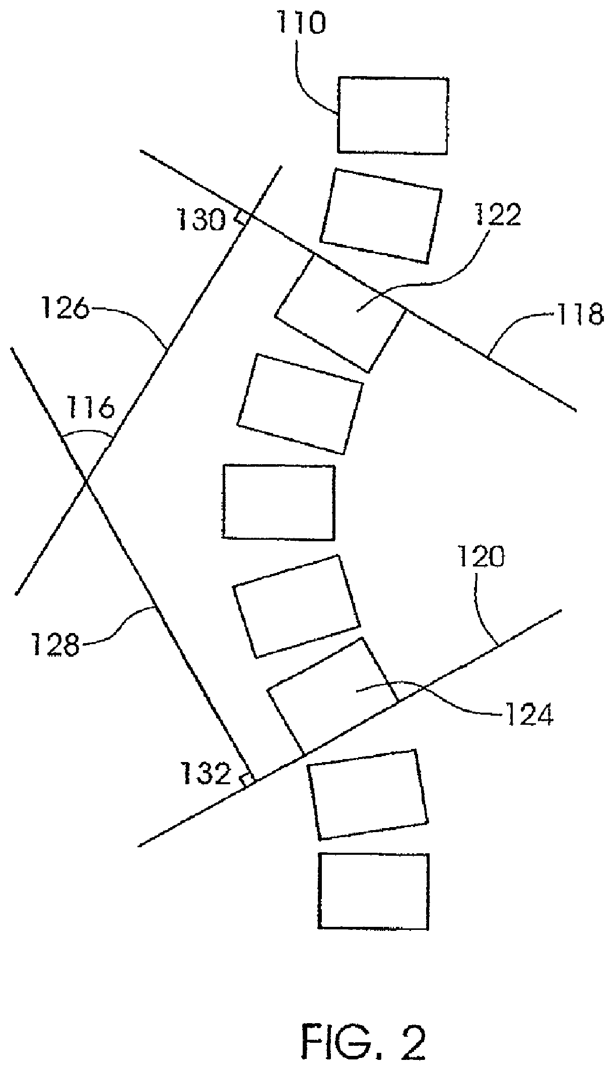 Patent US12318119 Figure 2 – Adjustable implant system