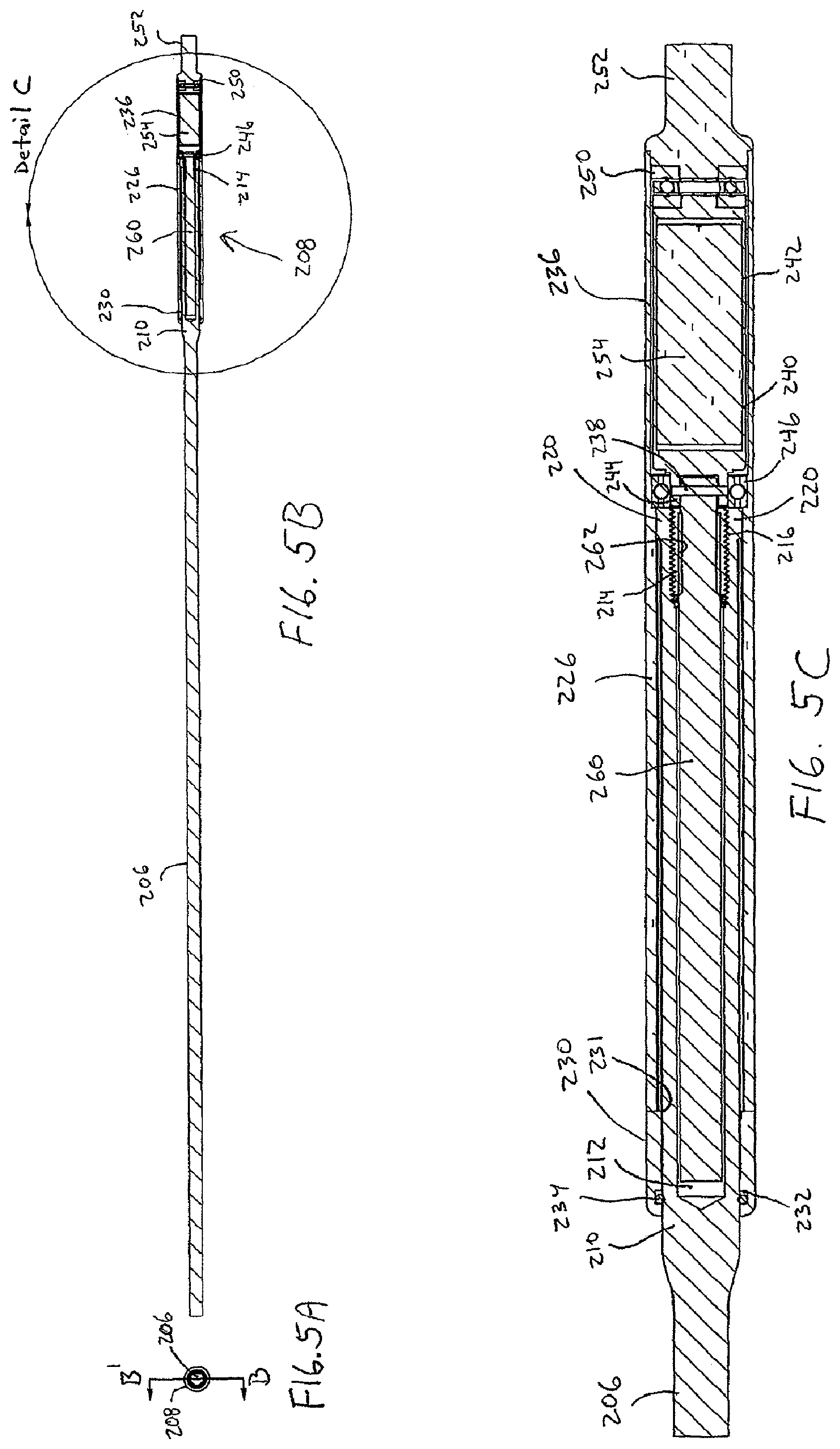 Patent US12318119 Figure 5 – Adjustable implant system