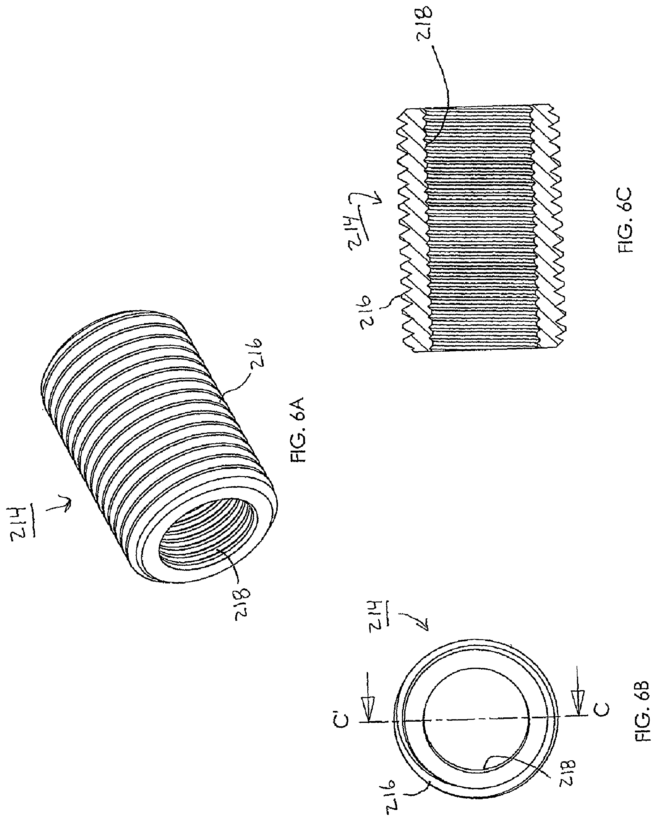 Patent US12318119 Figure 6 – Adjustable implant system