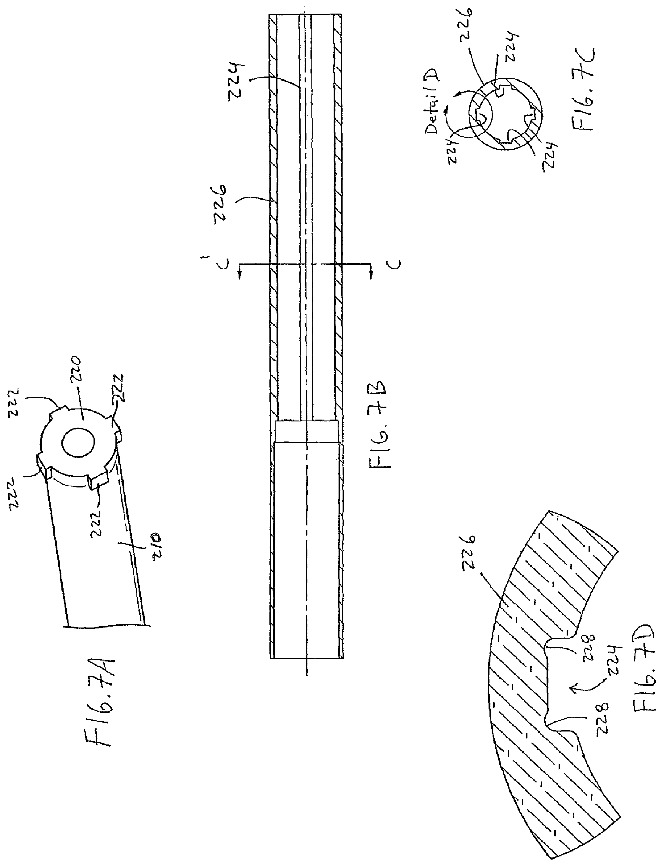 Patent US12318119 Figure 7 – Adjustable implant system