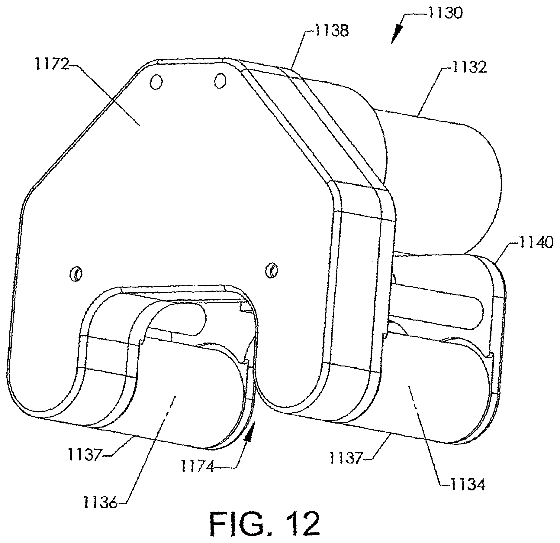Patent US12318119 Figure 12 – Adjustable implant system