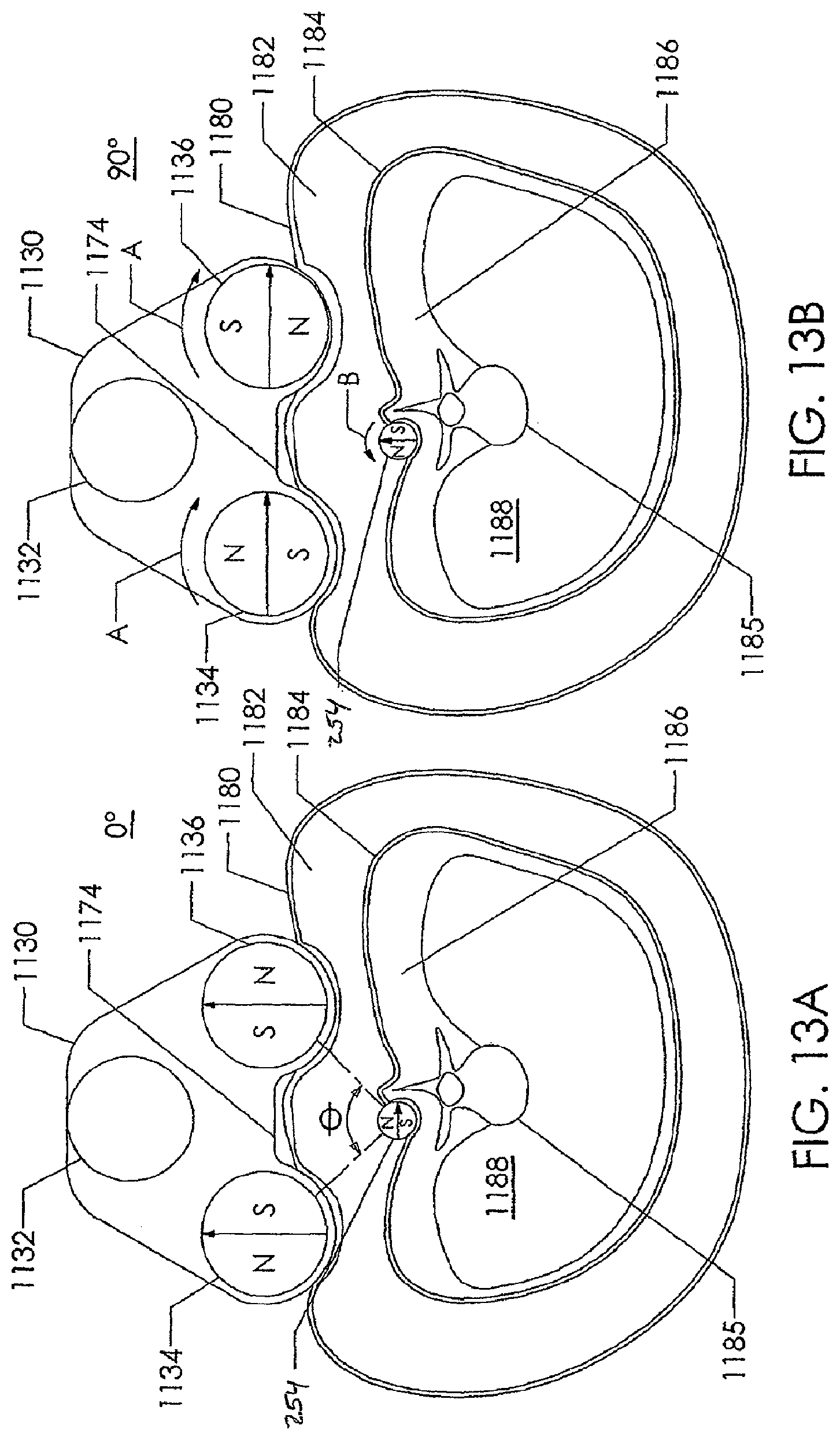 Patent US12318119 Figure 13 – Adjustable implant system