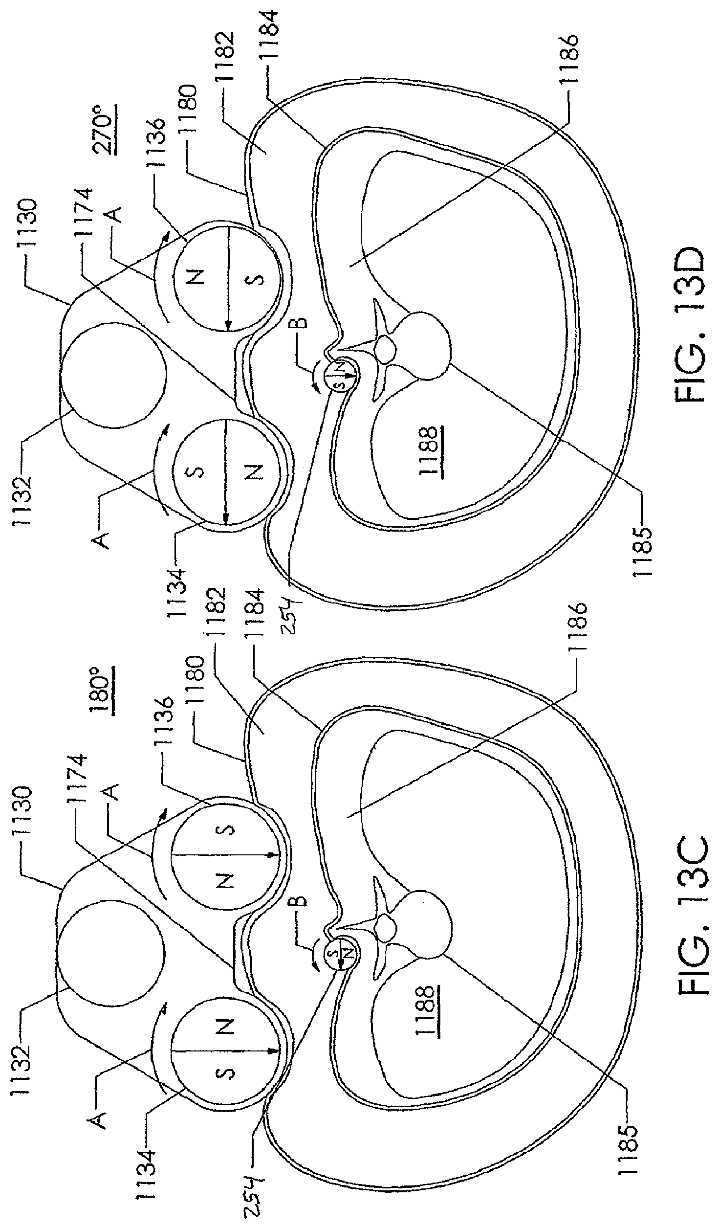 Patent US12318119 Figure 14 – Adjustable implant system