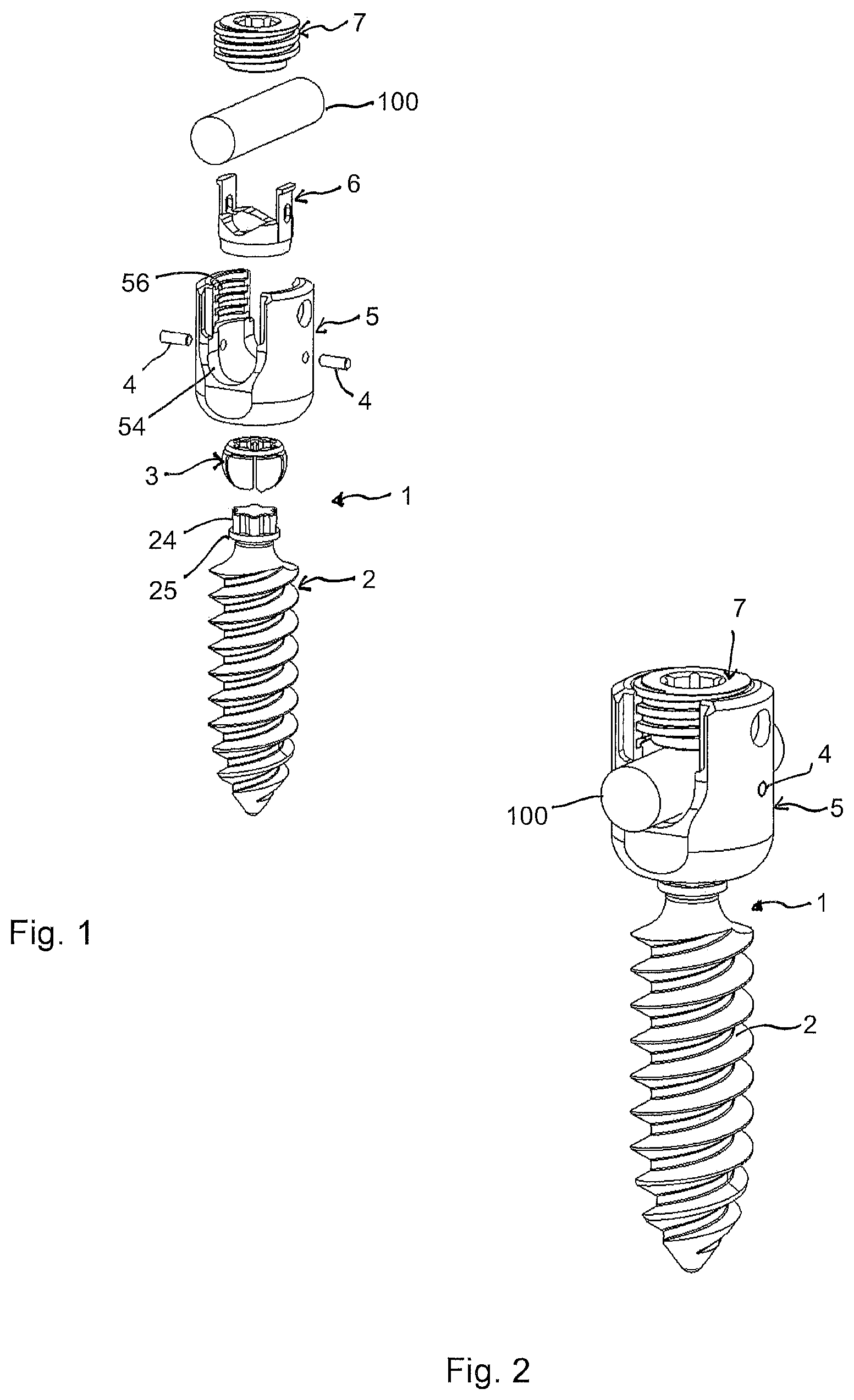 Patent US12318120 Figure 1 – Bone anchoring device