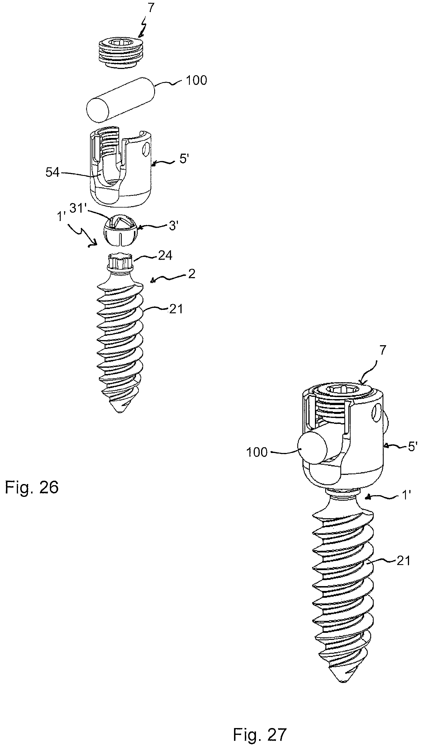 Patent US12318120 Figure 12 – Bone anchoring device