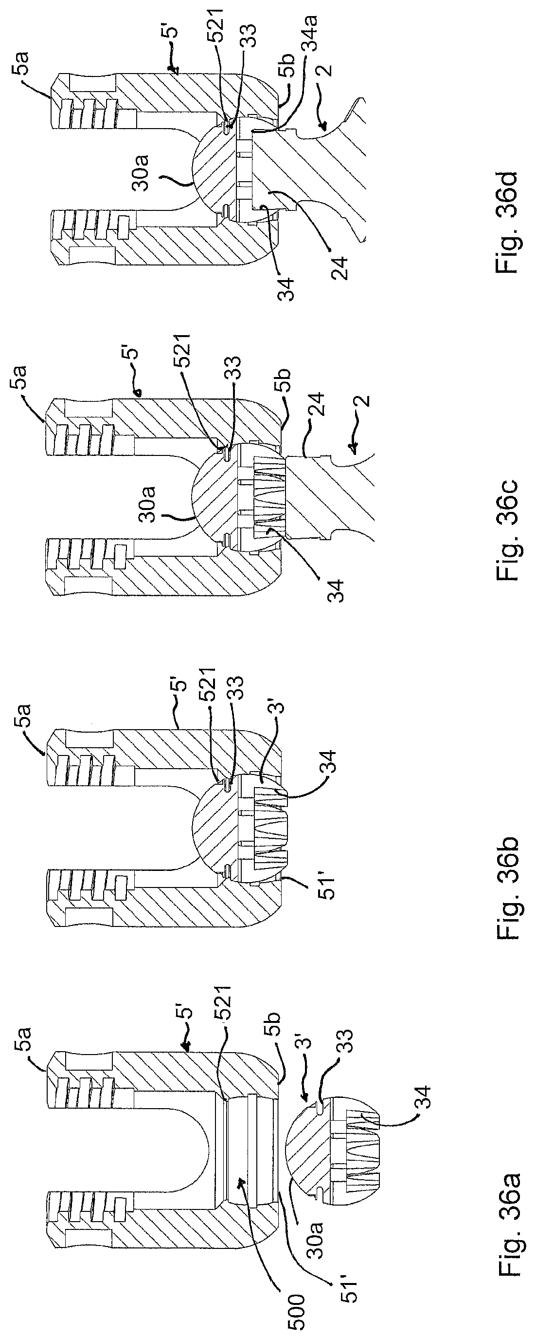 Patent US12318120 Figure 15 – Bone anchoring device