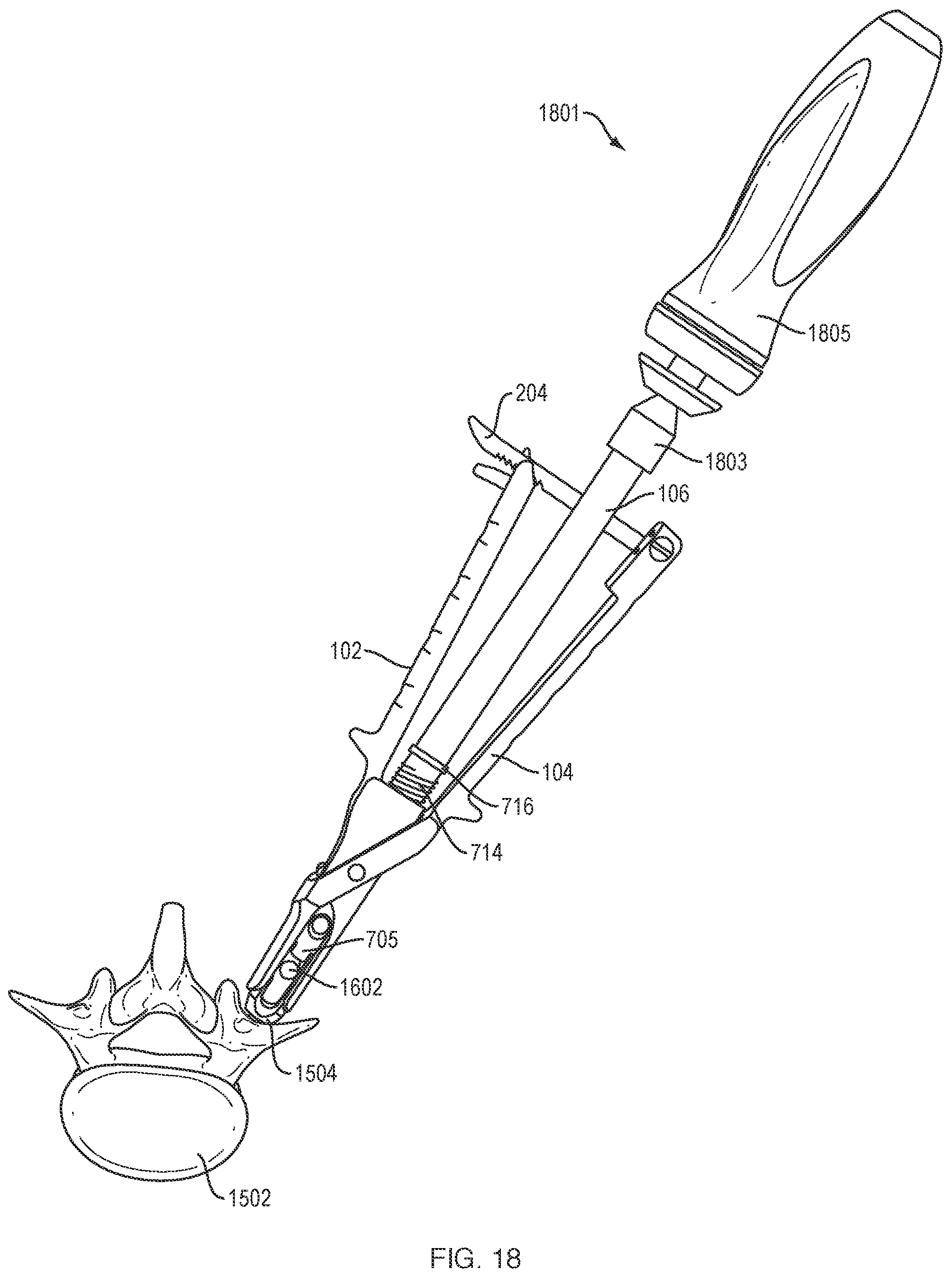 Patent US12318121 Figure 15 – Biplanar forceps reducers and methods of use