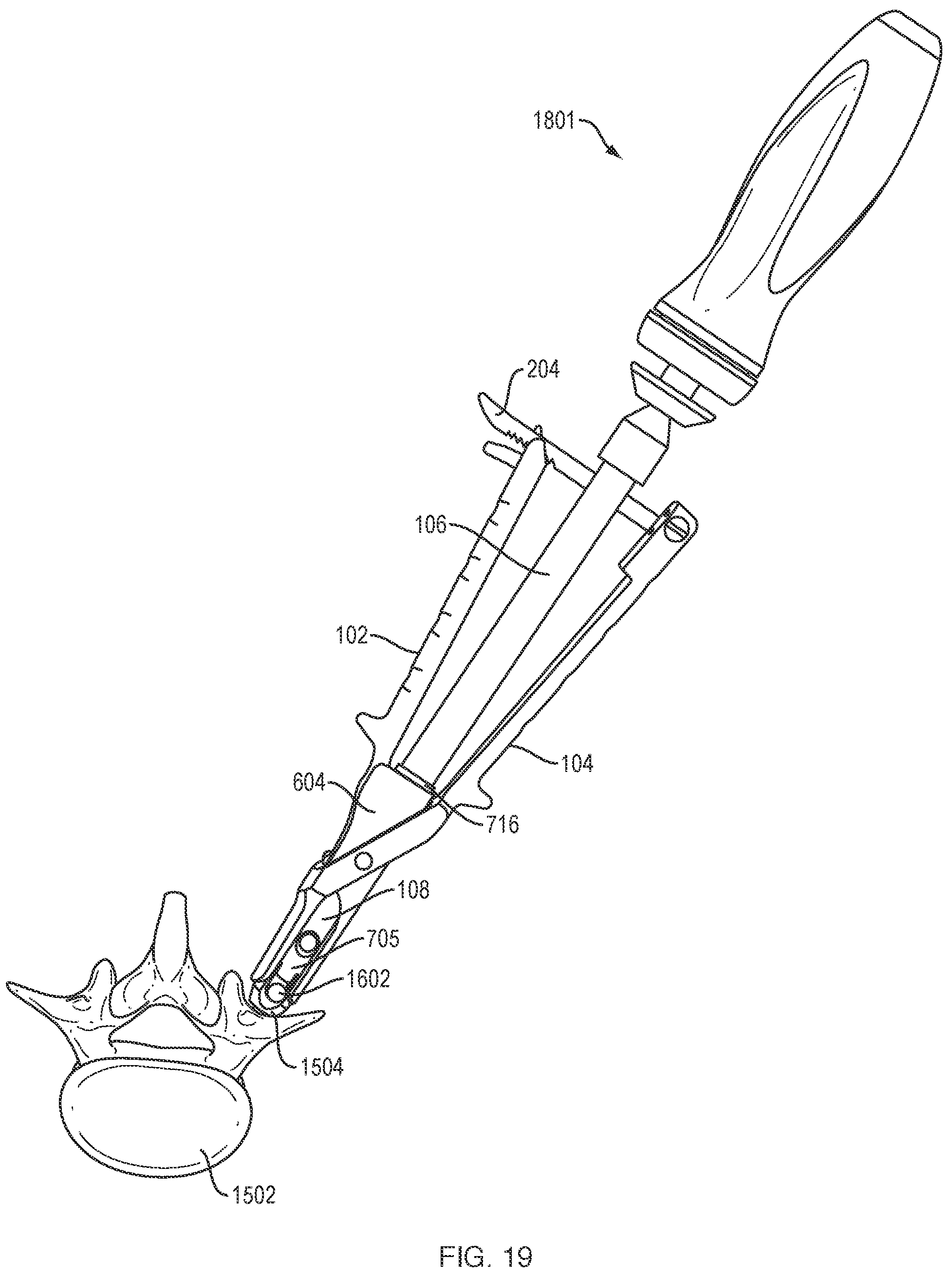 Patent US12318121 Figure 16 – Biplanar forceps reducers and methods of use