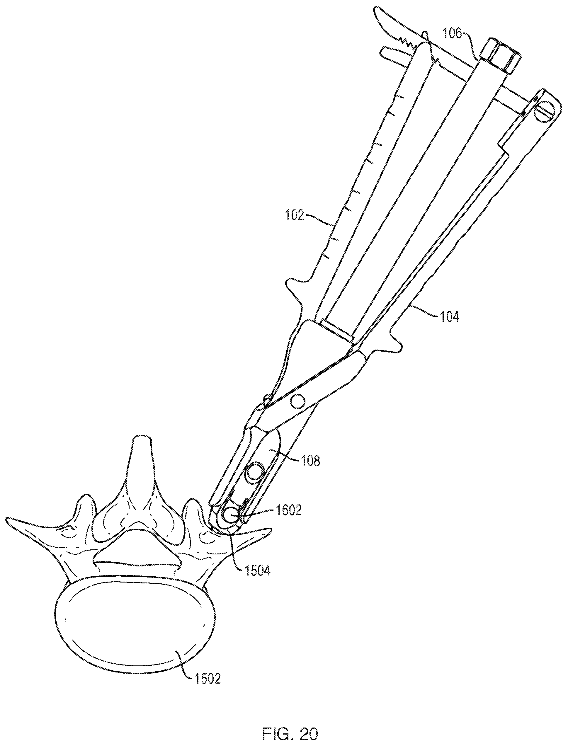 Patent US12318121 Figure 17 – Biplanar forceps reducers and methods of use