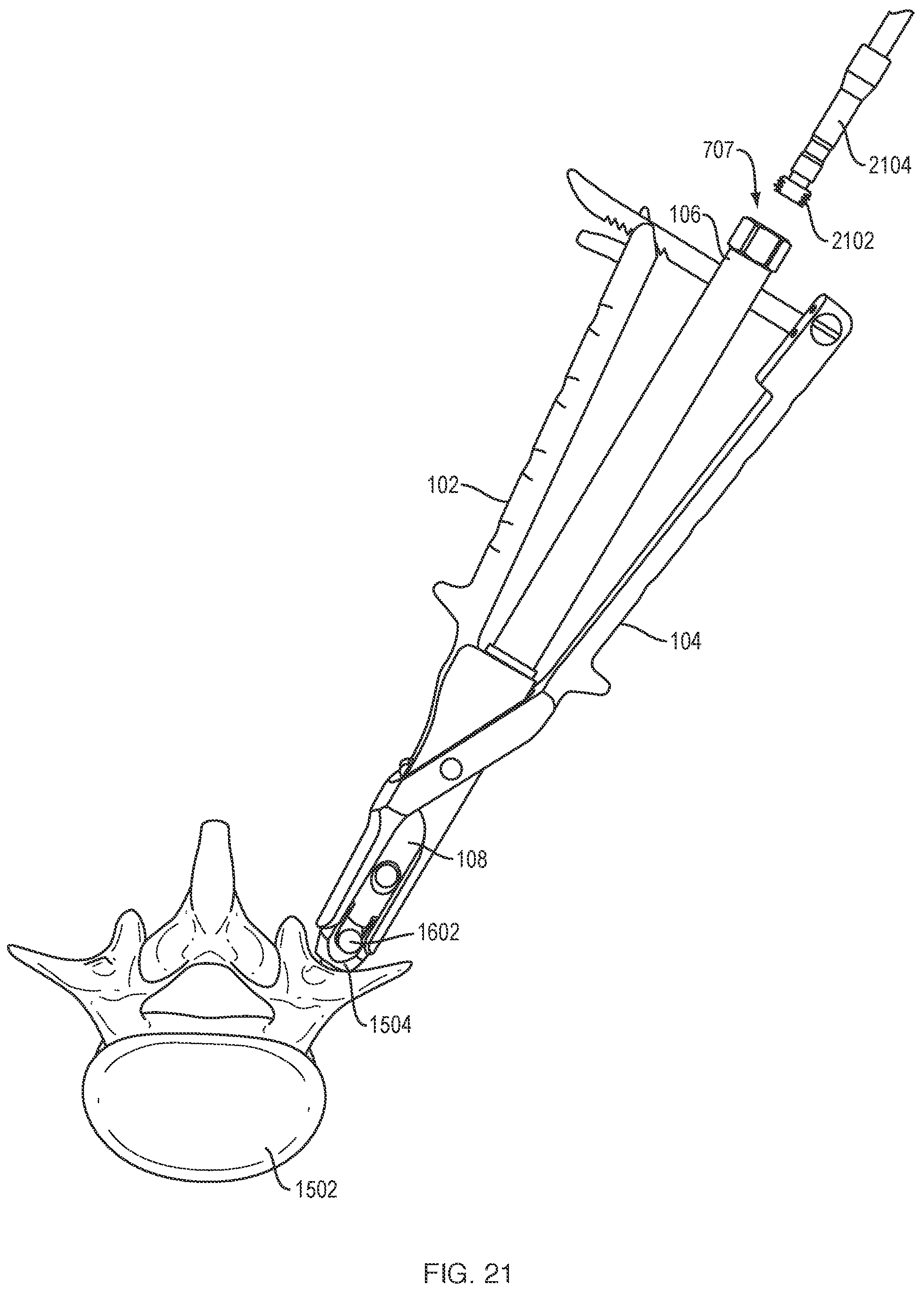 Patent US12318121 Figure 18 – Biplanar forceps reducers and methods of use