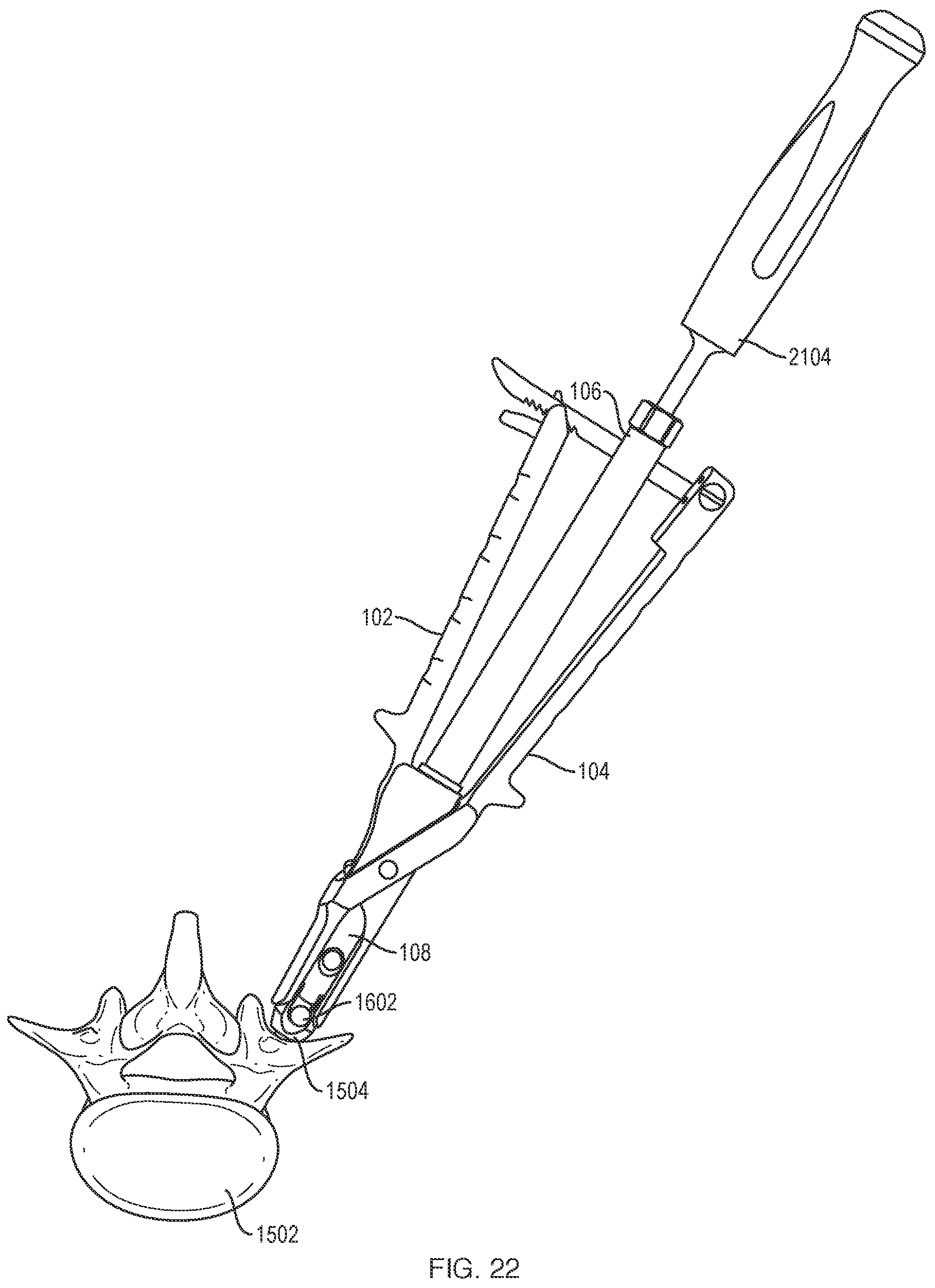 Patent US12318121 Figure 19 – Biplanar forceps reducers and methods of use