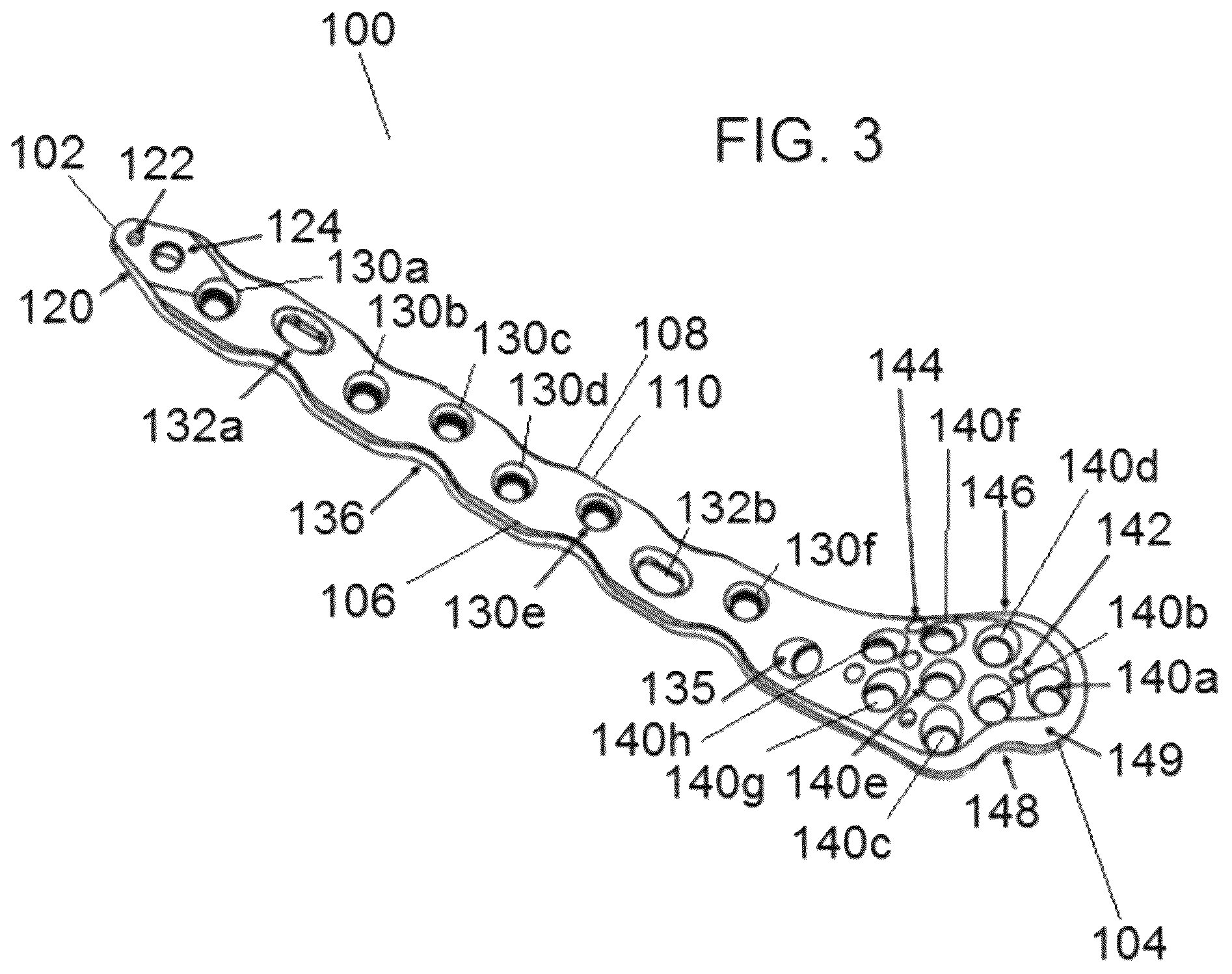 Patent US12318122 Figure 3 – Bone stabilization systems
