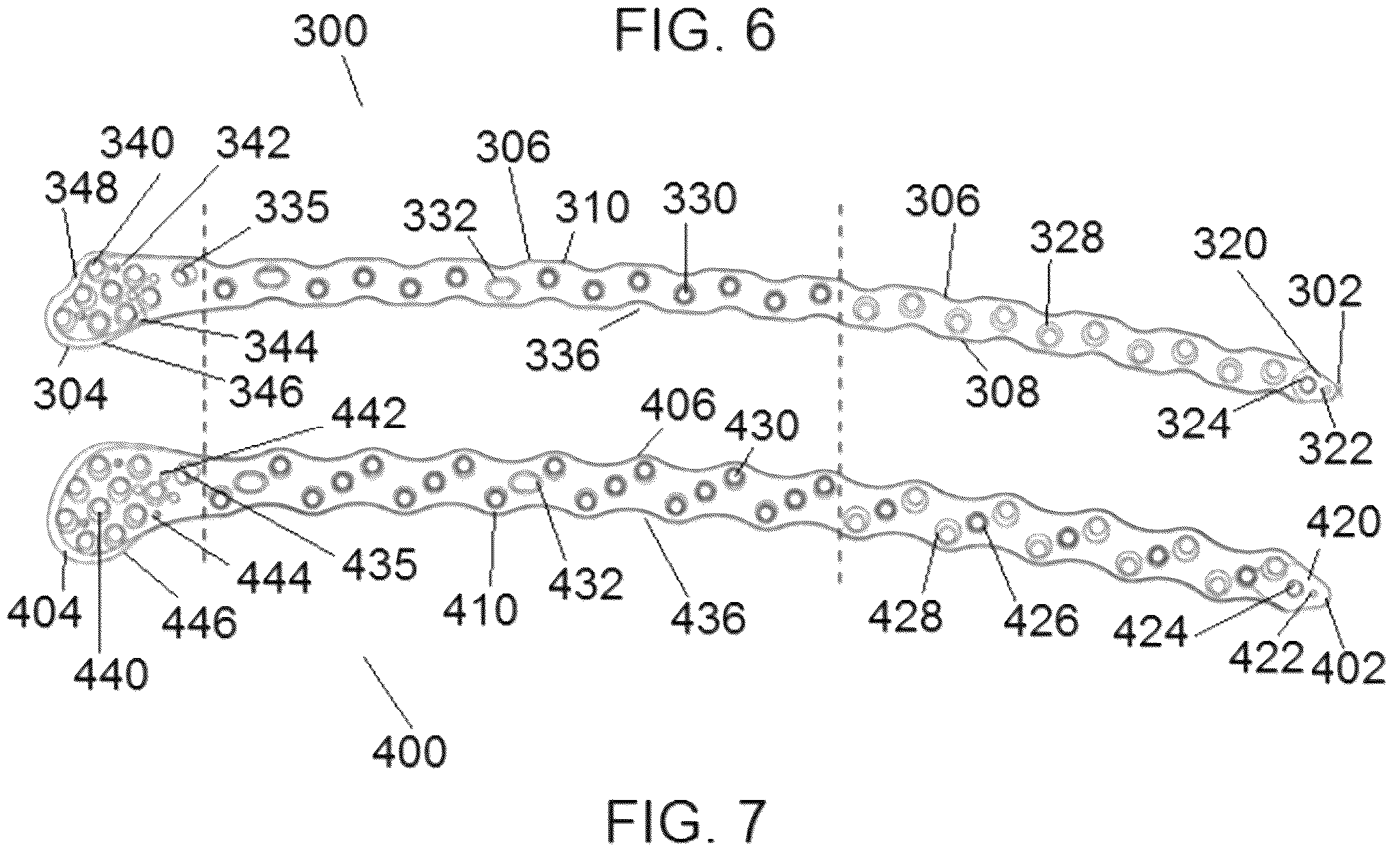Patent US12318122 Figure 6 – Bone stabilization systems