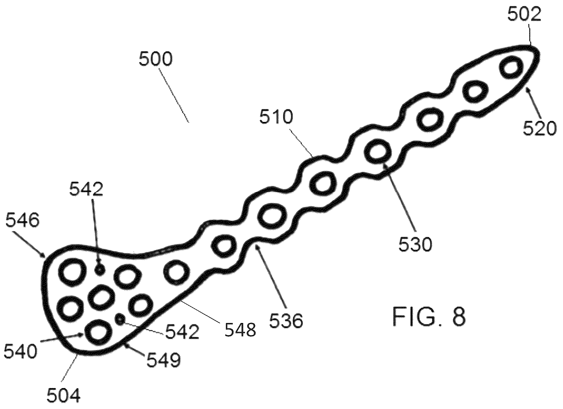 Patent US12318122 Figure 7 – Bone stabilization systems