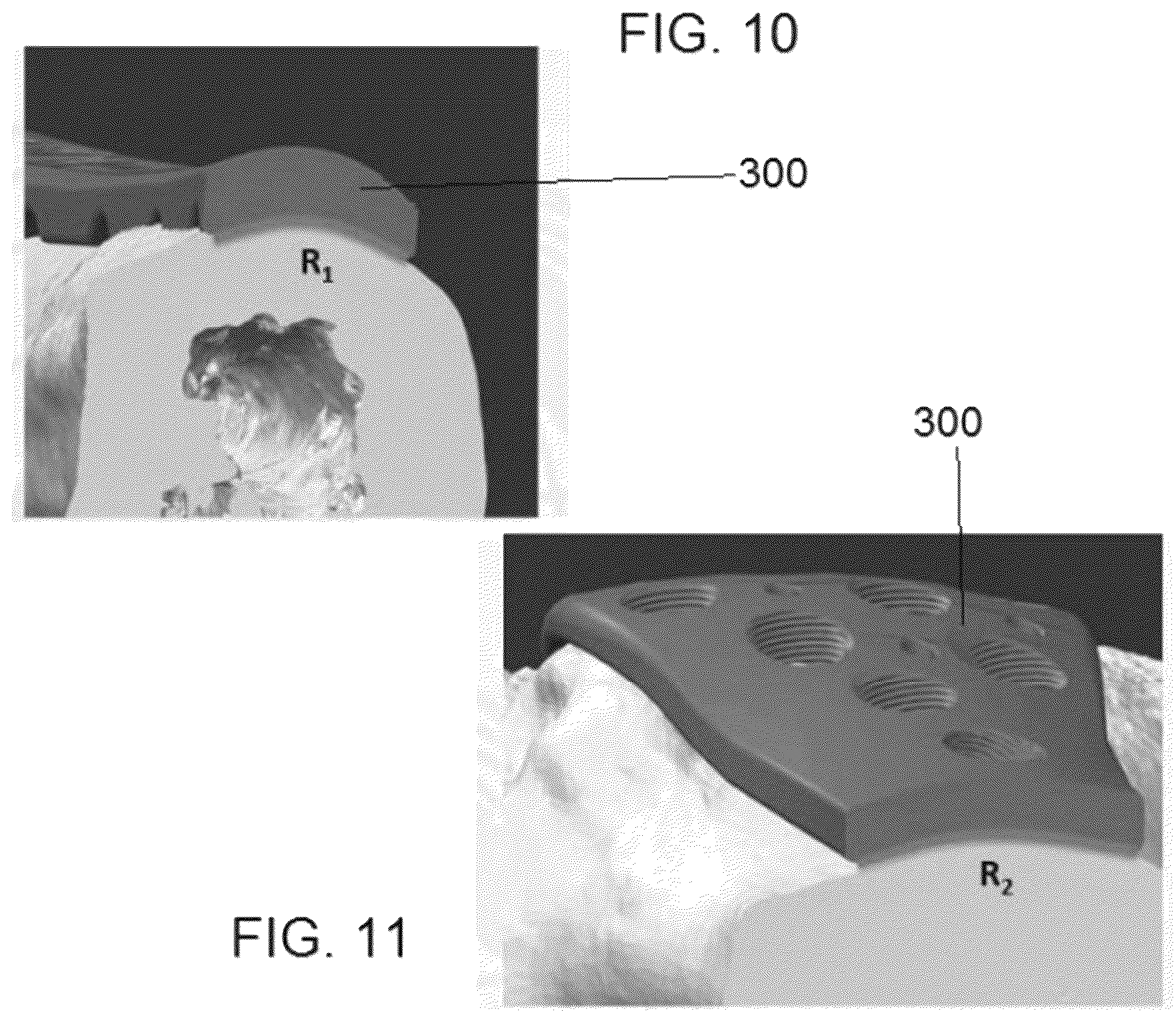 Patent US12318122 Figure 9 – Bone stabilization systems