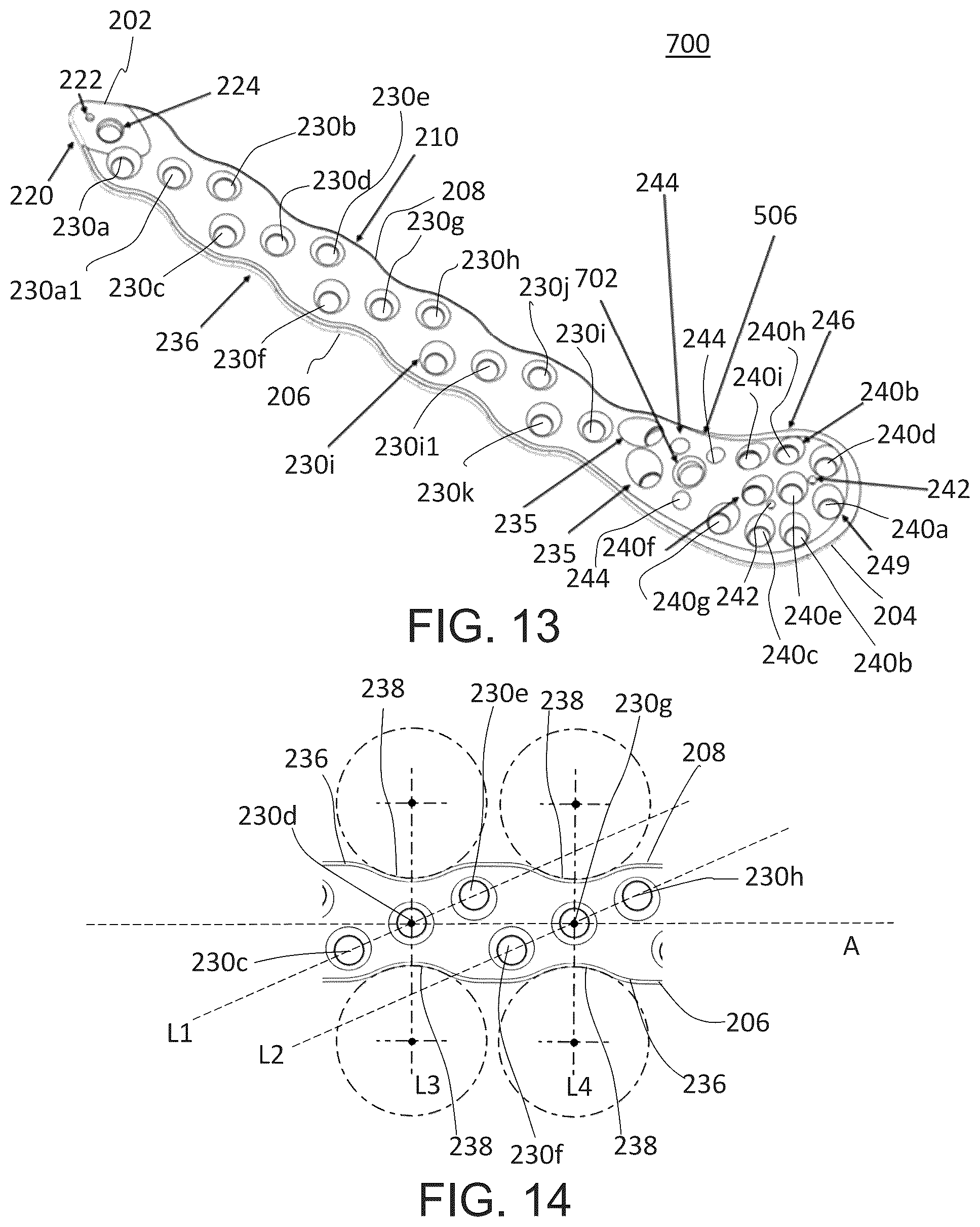 Patent US12318122 Figure 11 – Bone stabilization systems