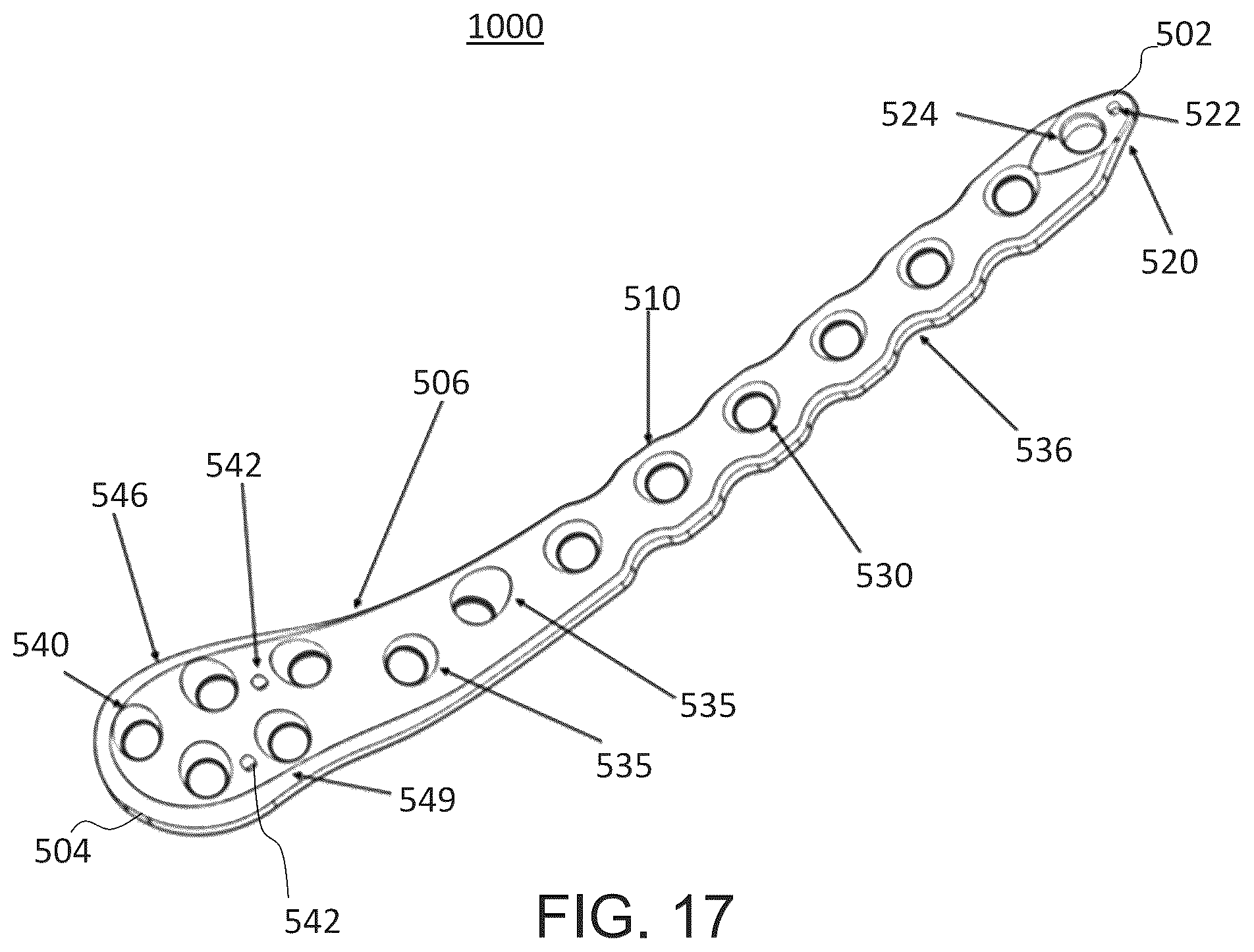 Patent US12318122 Figure 13 – Bone stabilization systems