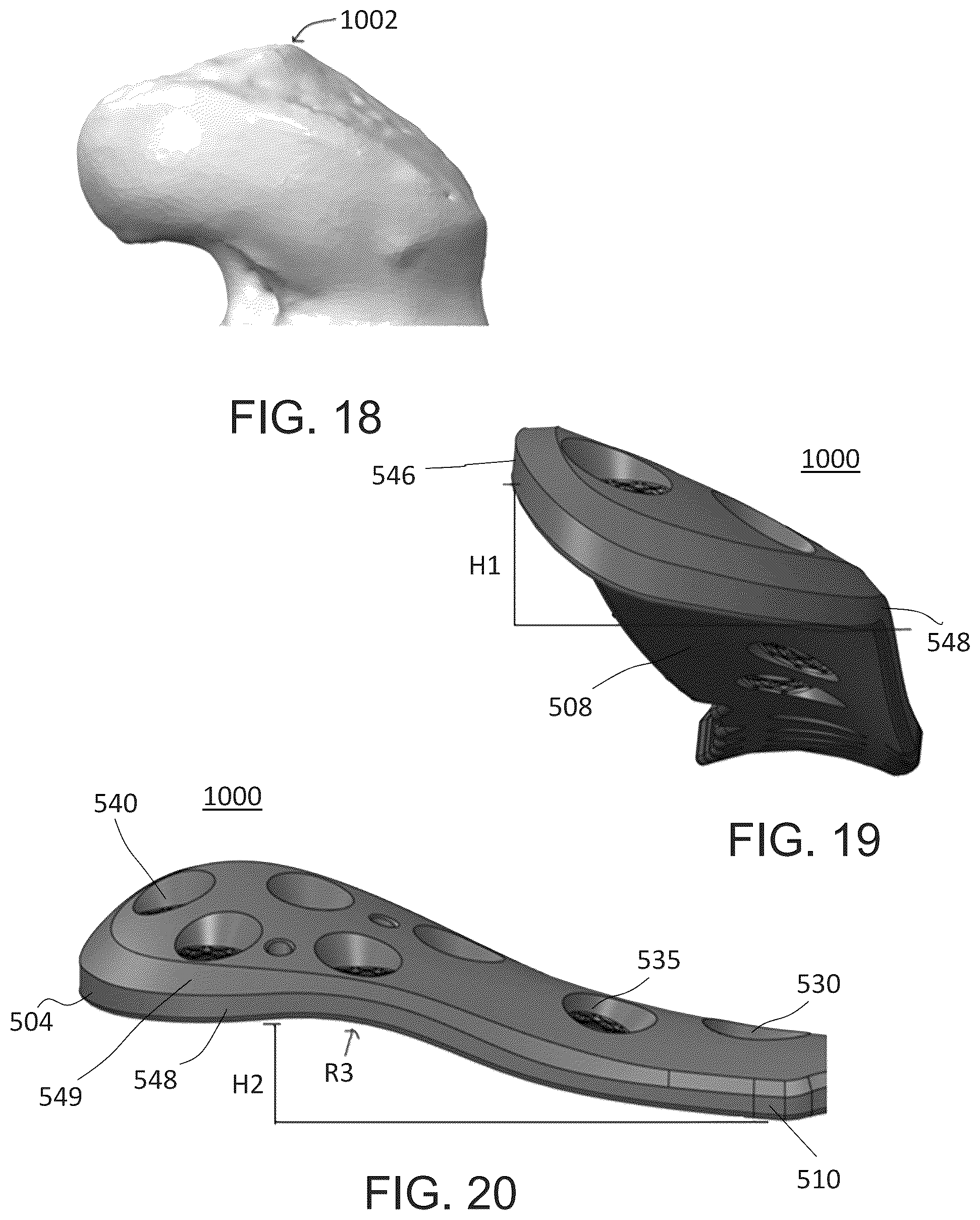 Patent US12318122 Figure 14 – Bone stabilization systems