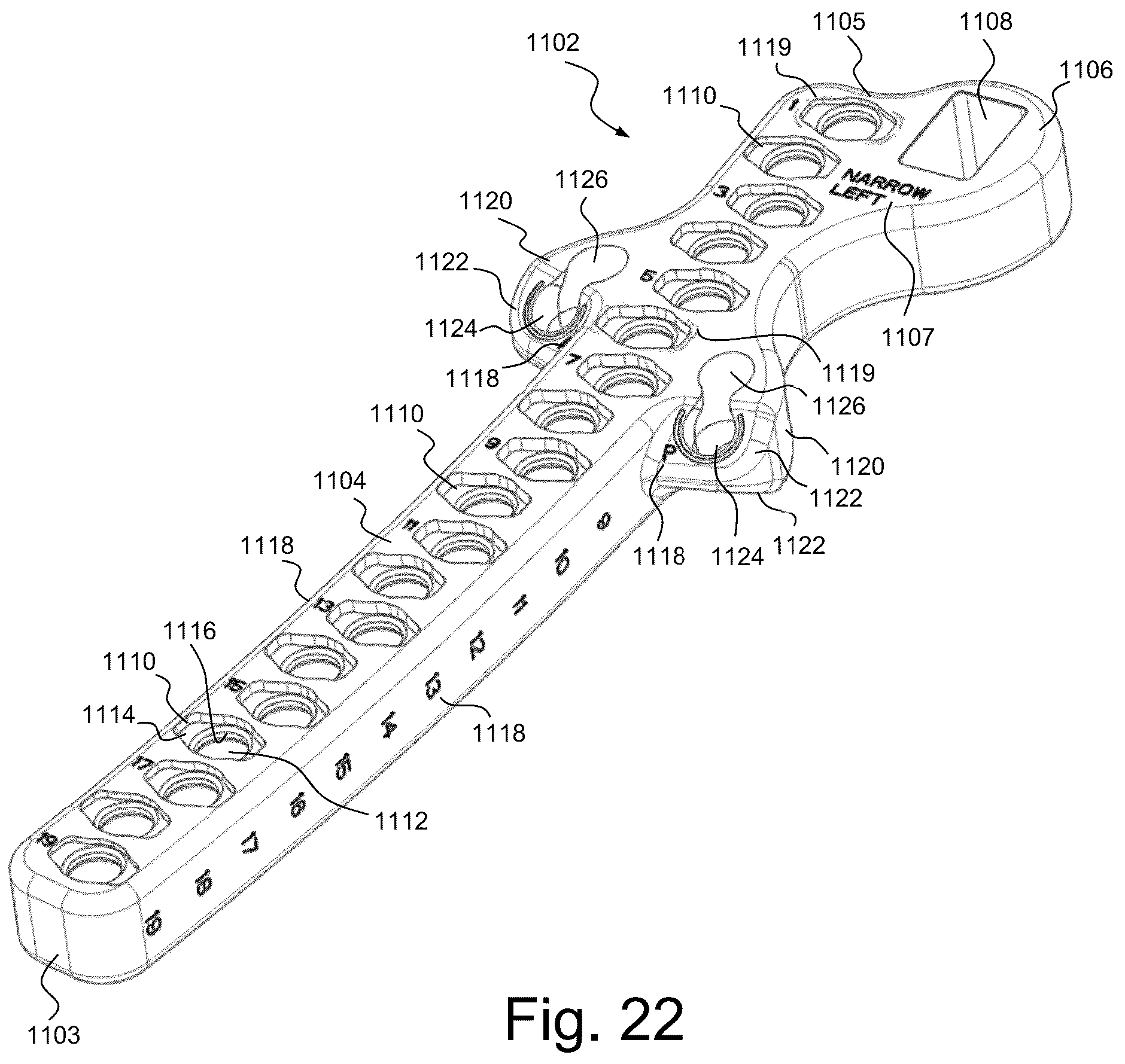 Patent US12318122 Figure 16 – Bone stabilization systems