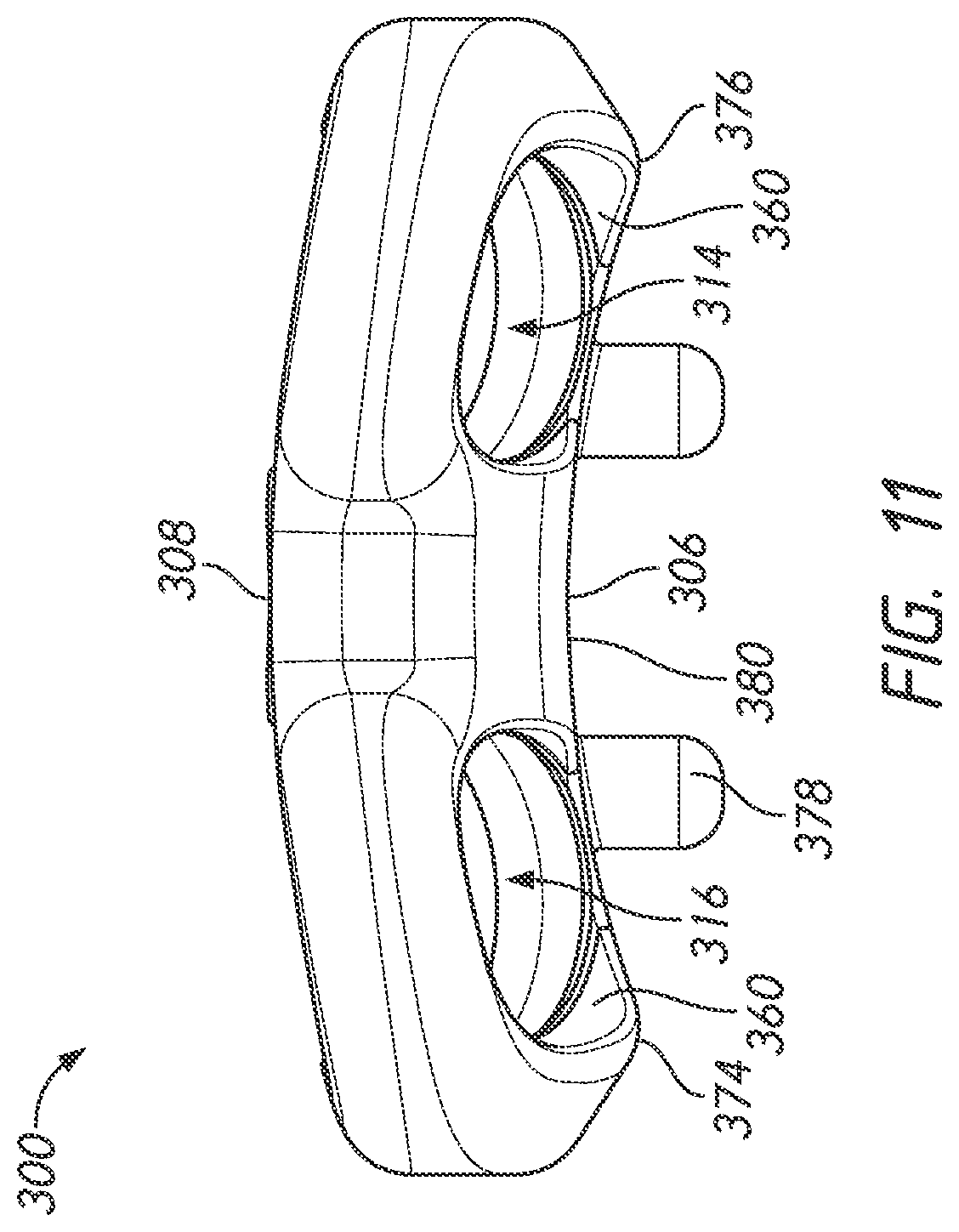 Patent US12318123 Figure 11 – Cervical plate and inserter