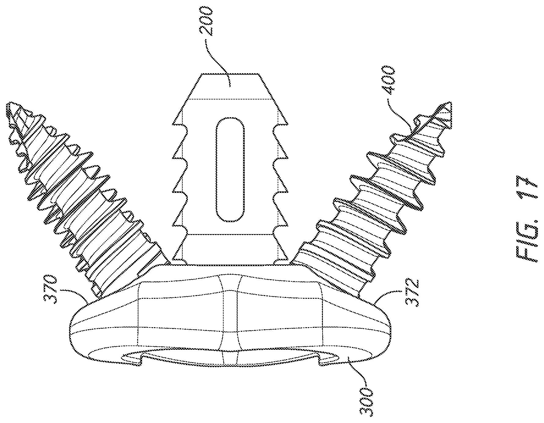 Patent US12318123 Figure 17 – Cervical plate and inserter