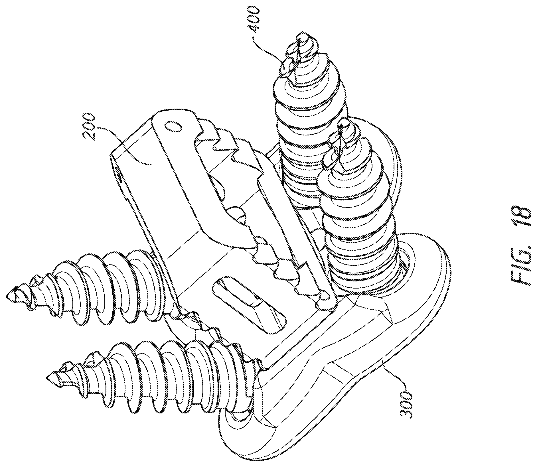 Patent US12318123 Figure 18 – Cervical plate and inserter