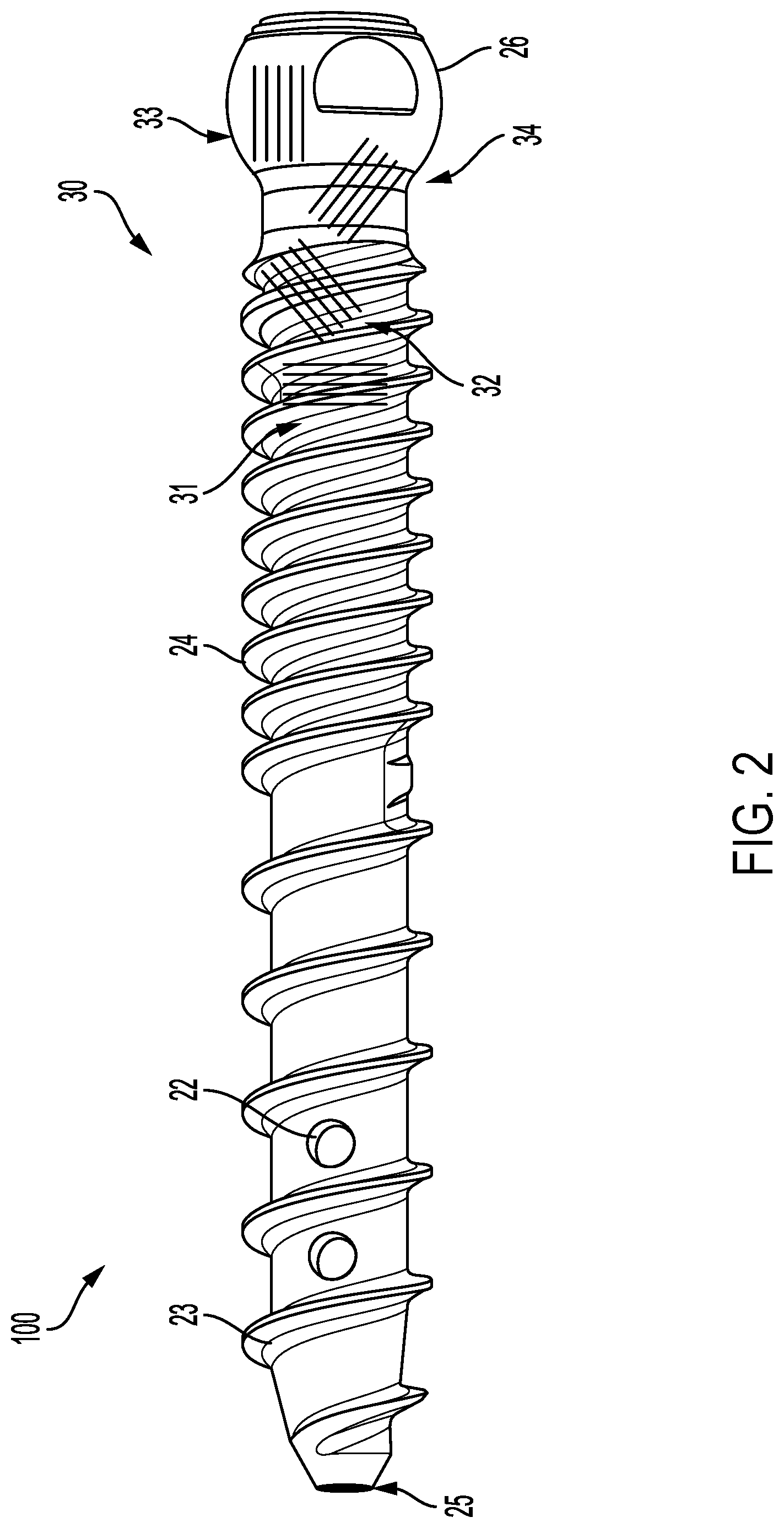 Patent US12318124 Figure 2 – Continuous fiber bone screw and method of manufacture