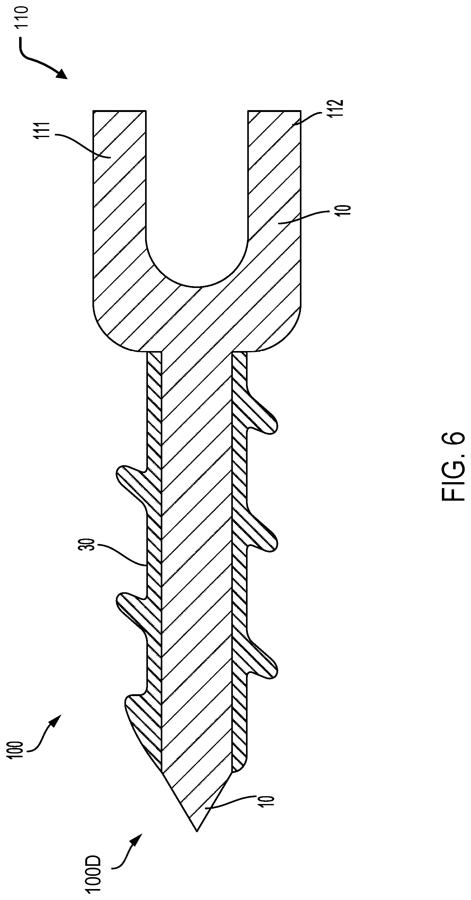 Patent US12318124 Figure 6 – Continuous fiber bone screw and method of manufacture