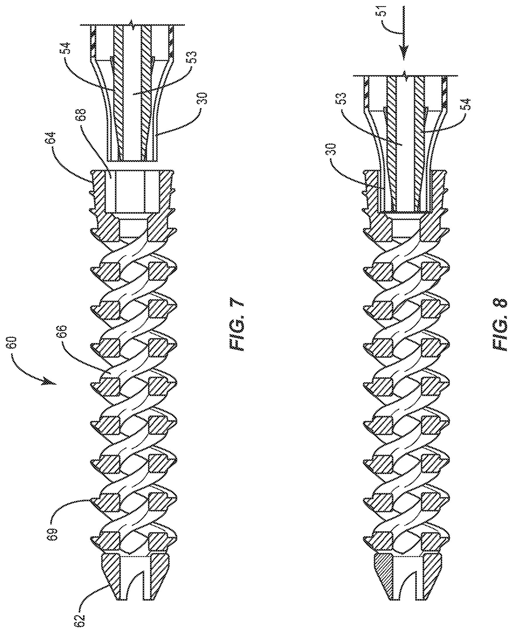 Patent US12318125 Figure 7 – Variable head driver for use with surgical implants