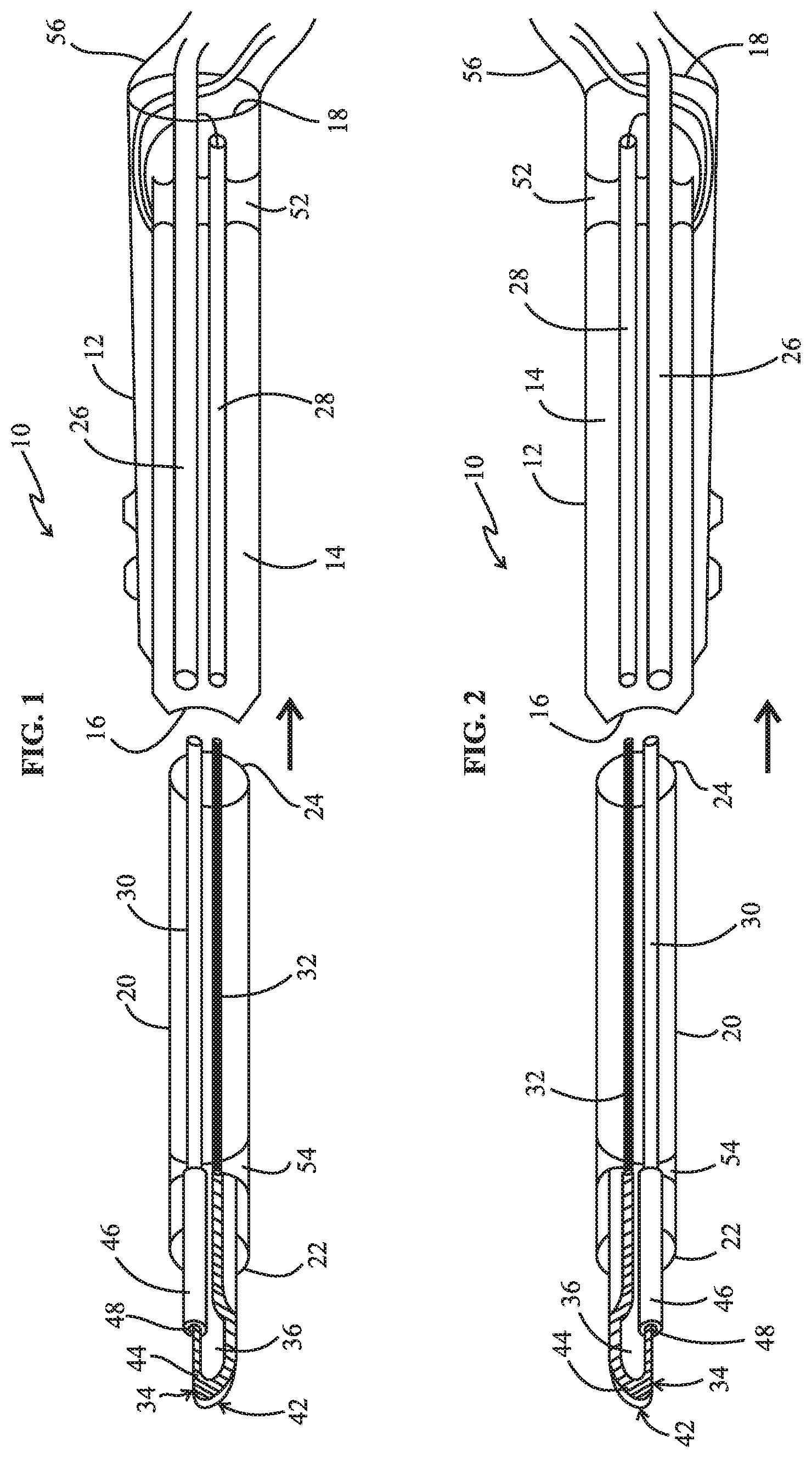 Patent US12318129 Figure 1 – Monopolar telescopic electrosurgery pencil