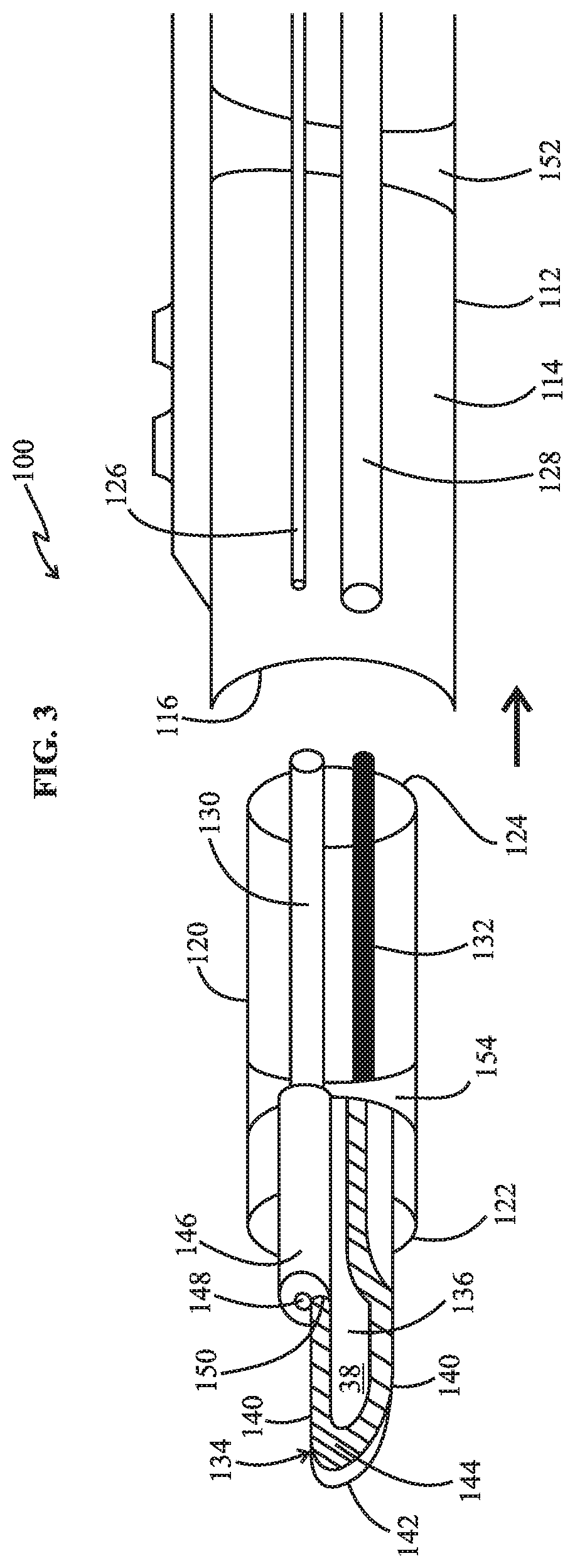 Patent US12318129 Figure 2 – Monopolar telescopic electrosurgery pencil