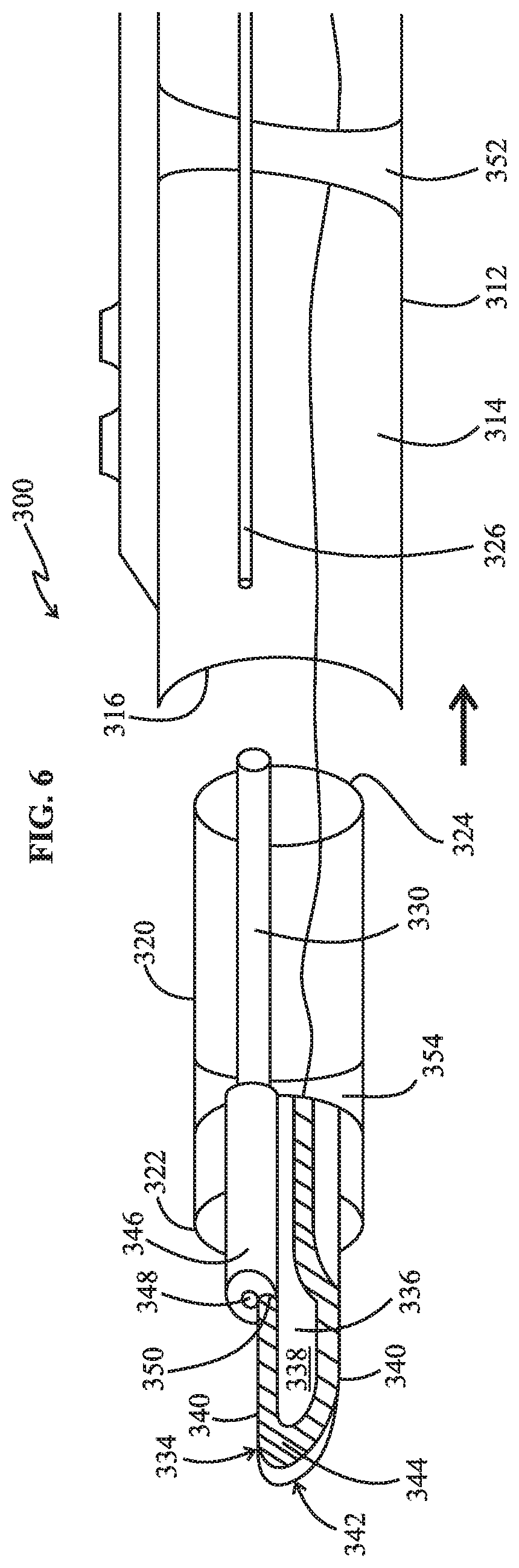 Patent US12318129 Figure 4 – Monopolar telescopic electrosurgery pencil