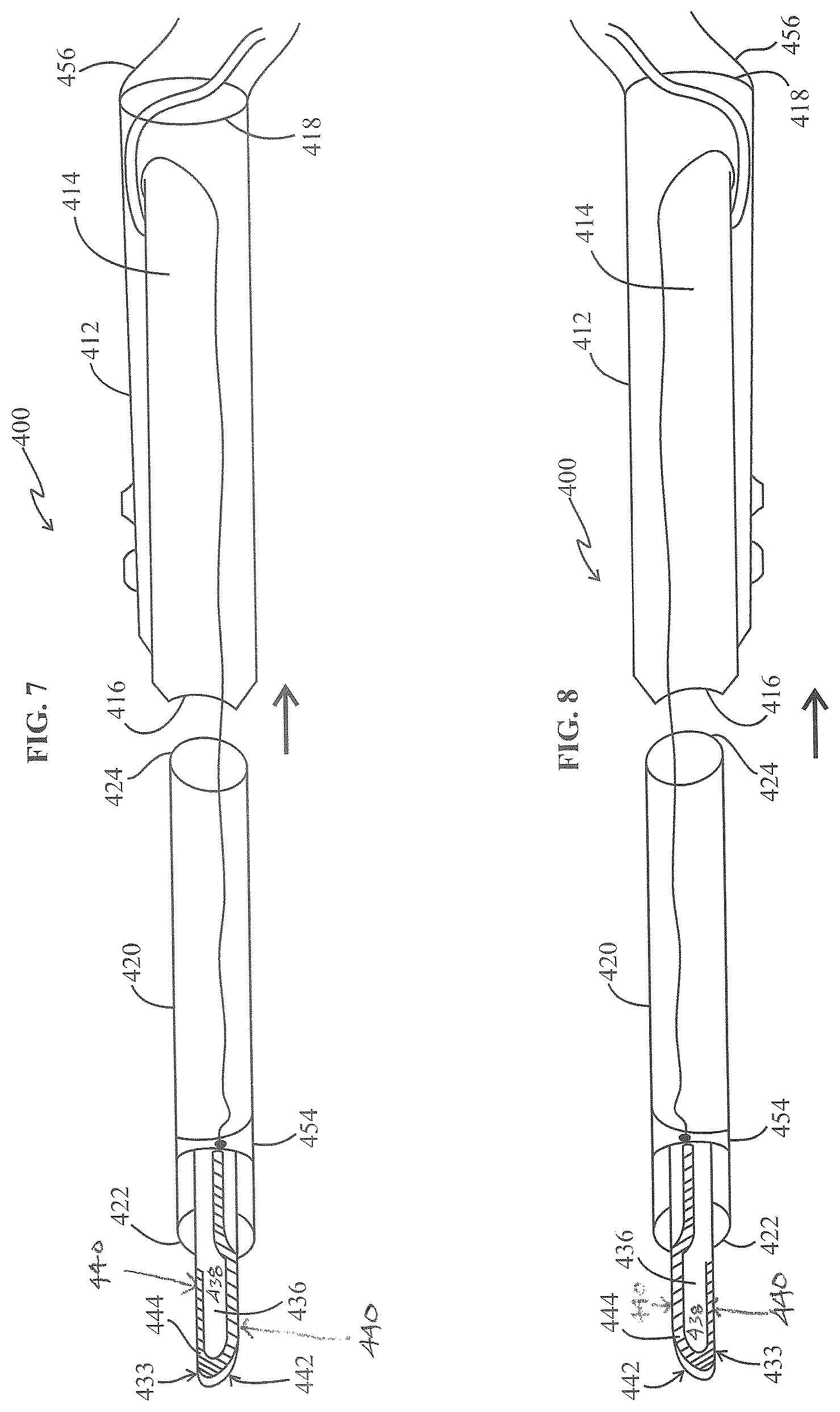 Patent US12318129 Figure 5 – Monopolar telescopic electrosurgery pencil