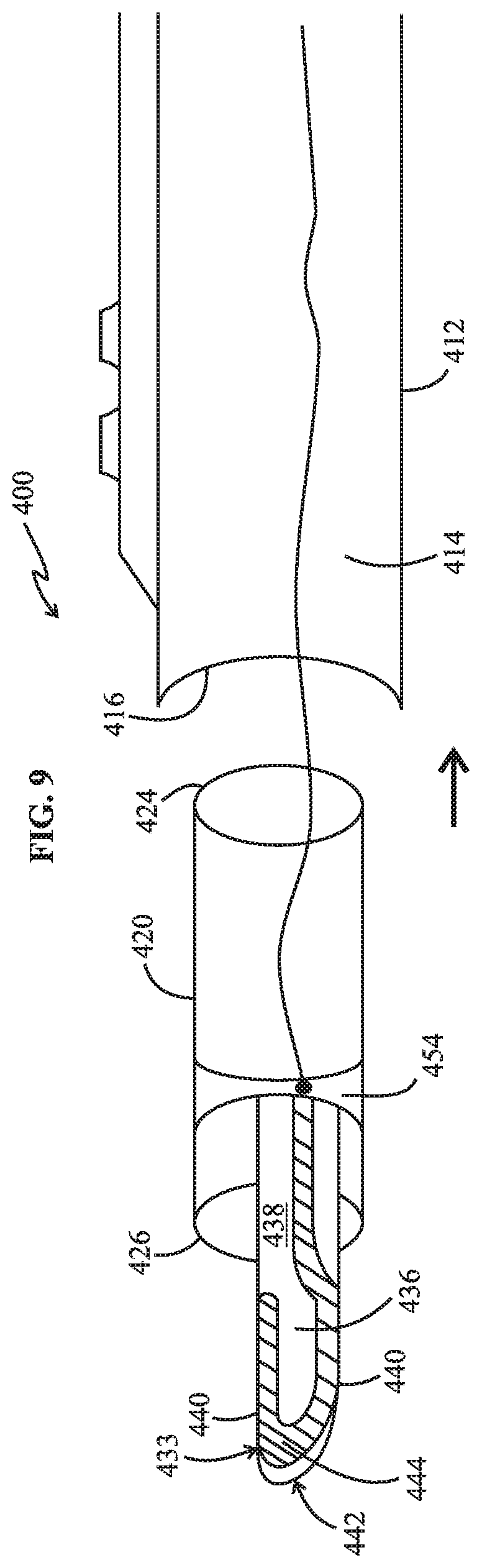 Patent US12318129 Figure 6 – Monopolar telescopic electrosurgery pencil