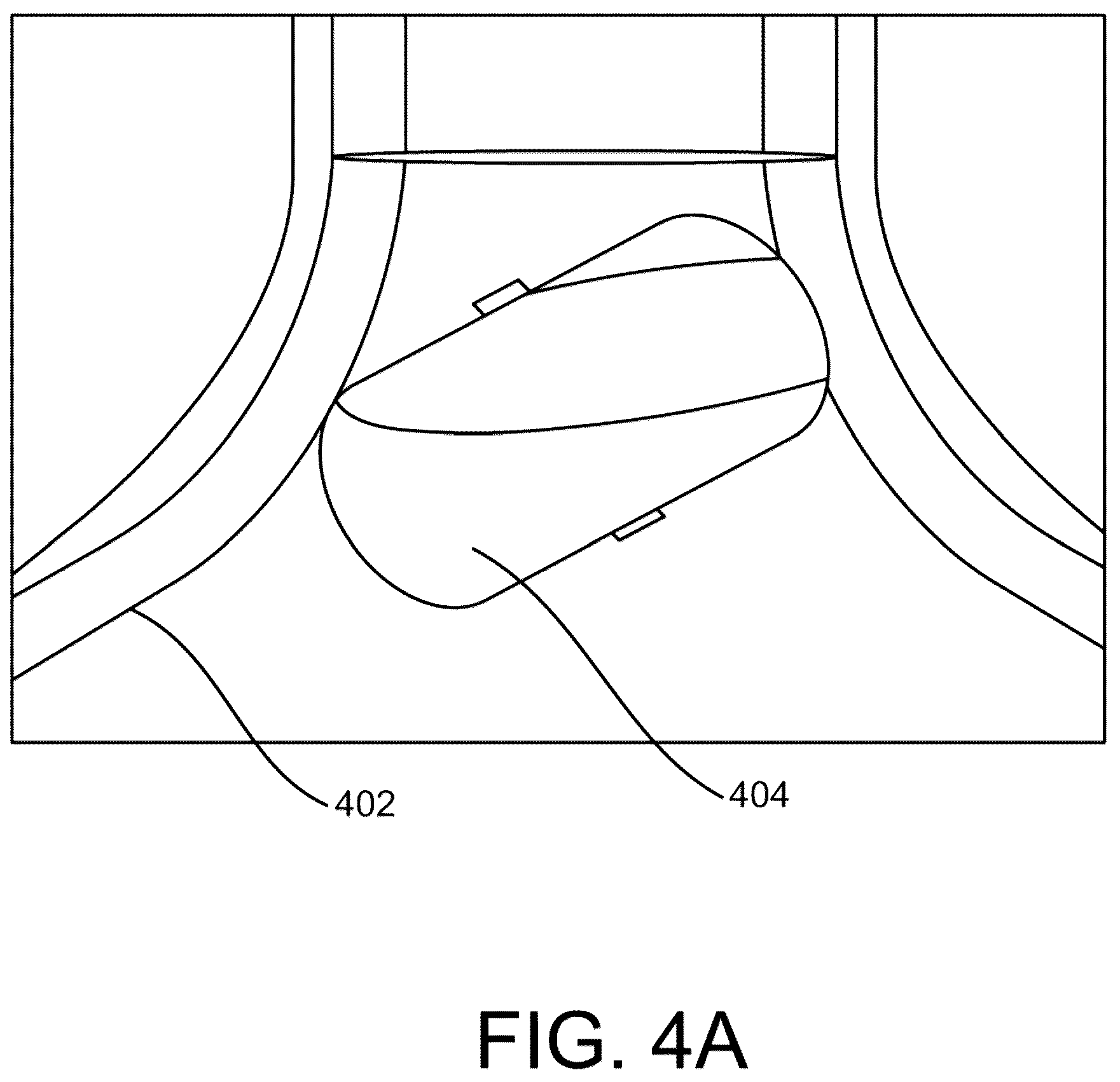 Patent US12318130 Figure 5 – Systems, apparatuses, and methods for delivery of pulsed electric field ablative energy to endocardial tissue