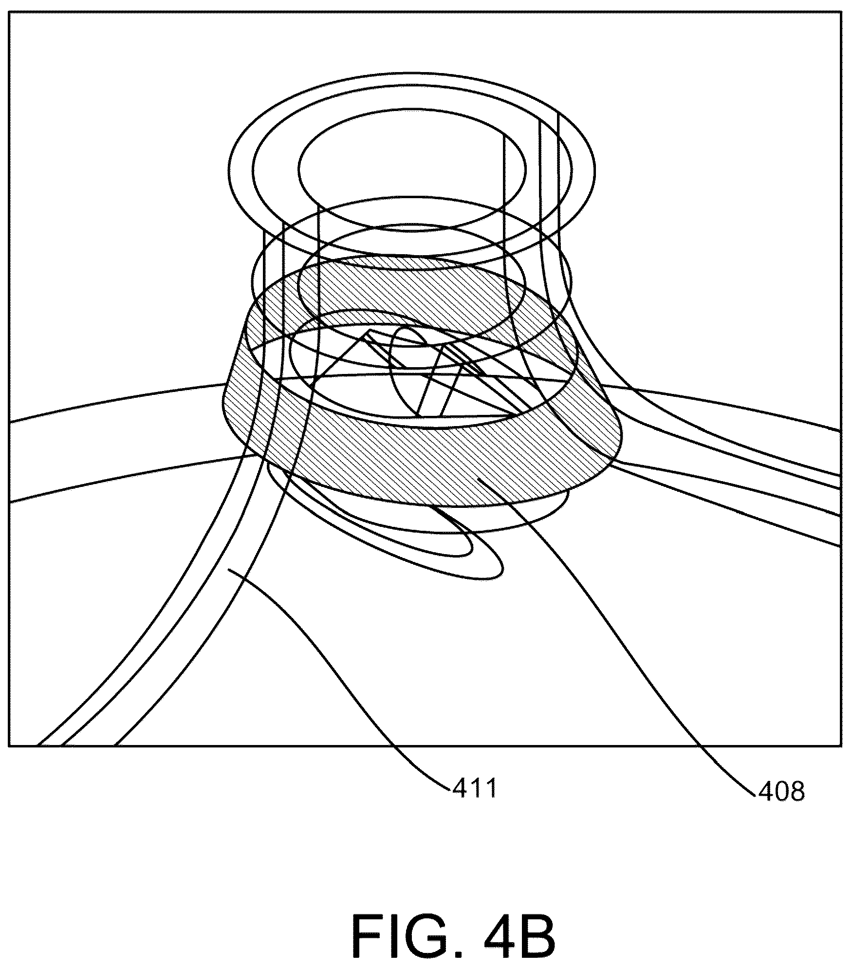 Patent US12318130 Figure 6 – Systems, apparatuses, and methods for delivery of pulsed electric field ablative energy to endocardial tissue