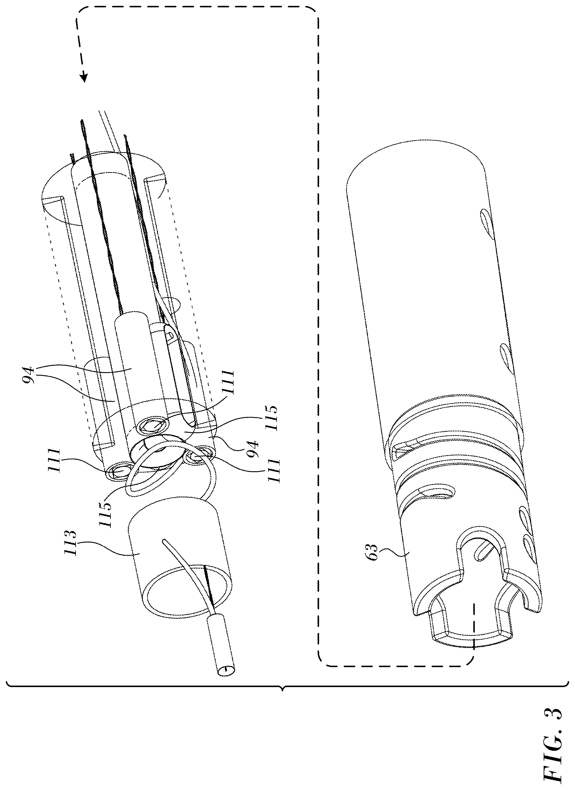 Patent US12318131 Figure 3 – Reduced size force sensor