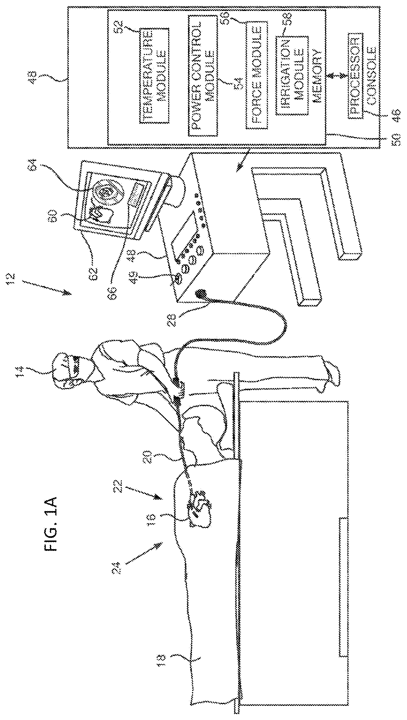Patent US12318132 Figure 1 – System and method for temperature control in irrigated ablation