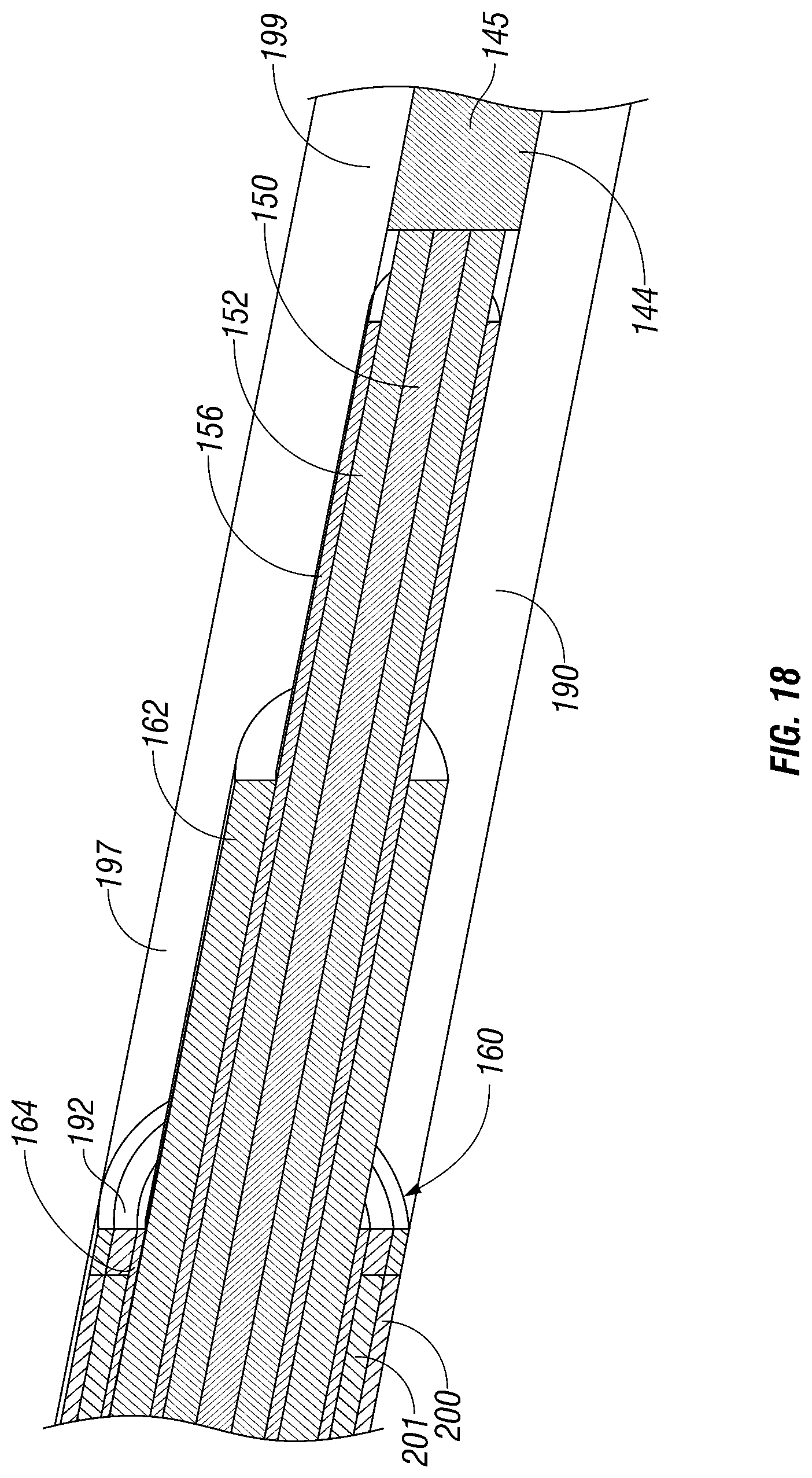 Patent US12318133 Figure 9 – Choked microwave antenna