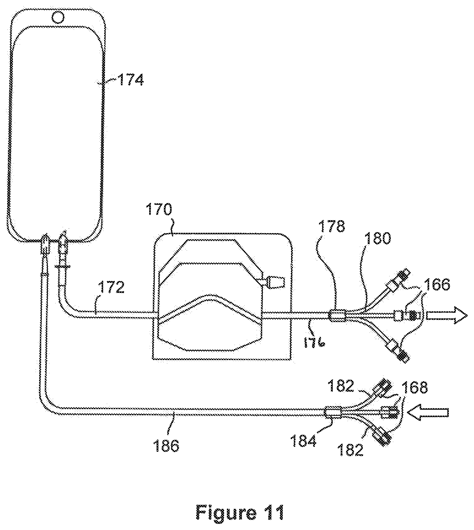 Patent US12318134 Figure 11 – Microwave coagulation applicator and system