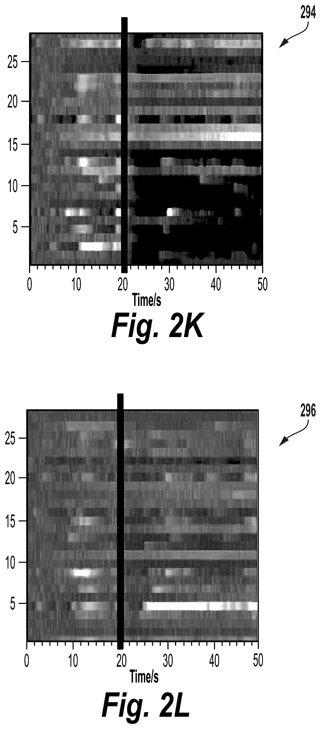 Patent US12318136 Figure 8 – Wireless neuromodulation via microwave split ring resonator