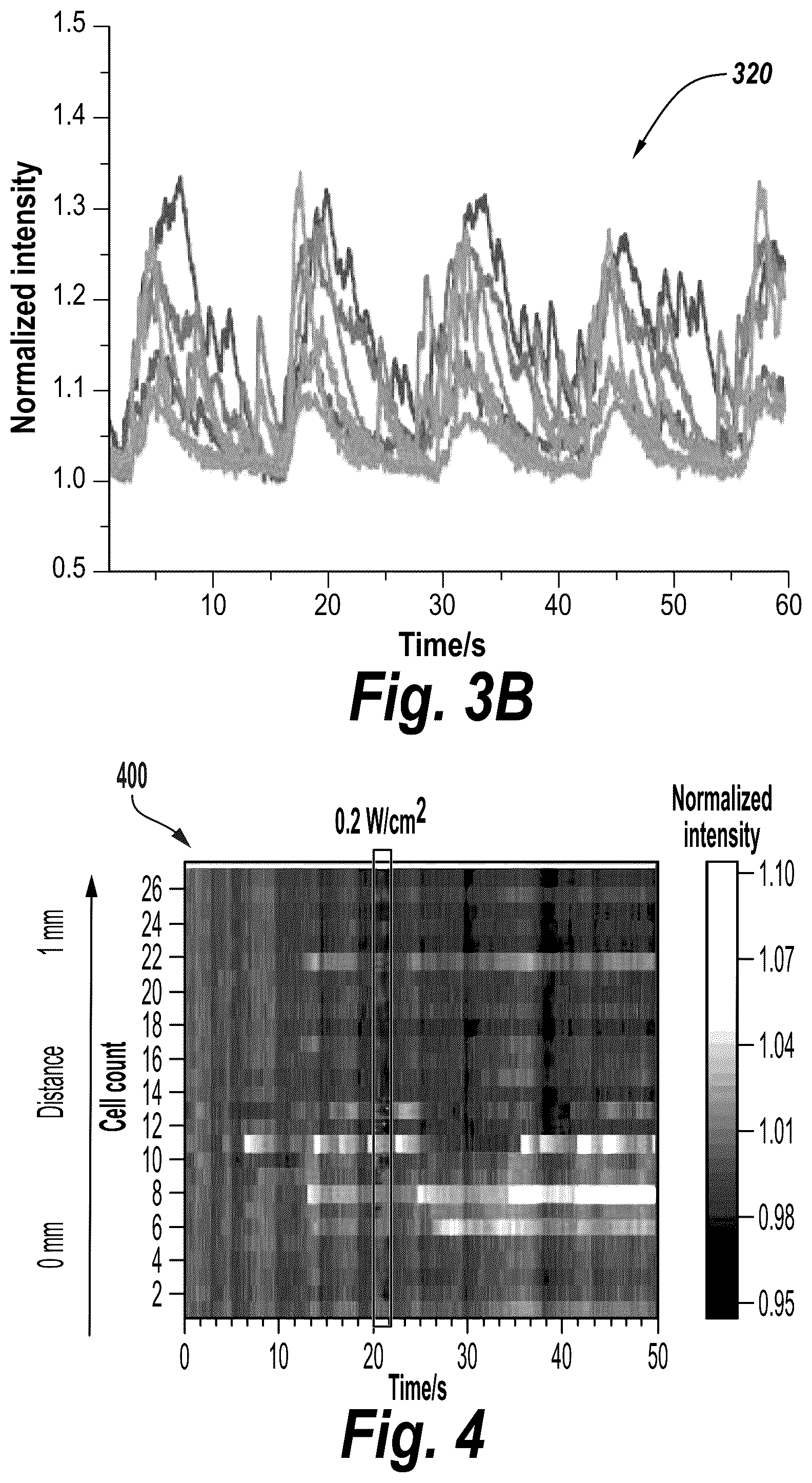 Patent US12318136 Figure 10 – Wireless neuromodulation via microwave split ring resonator