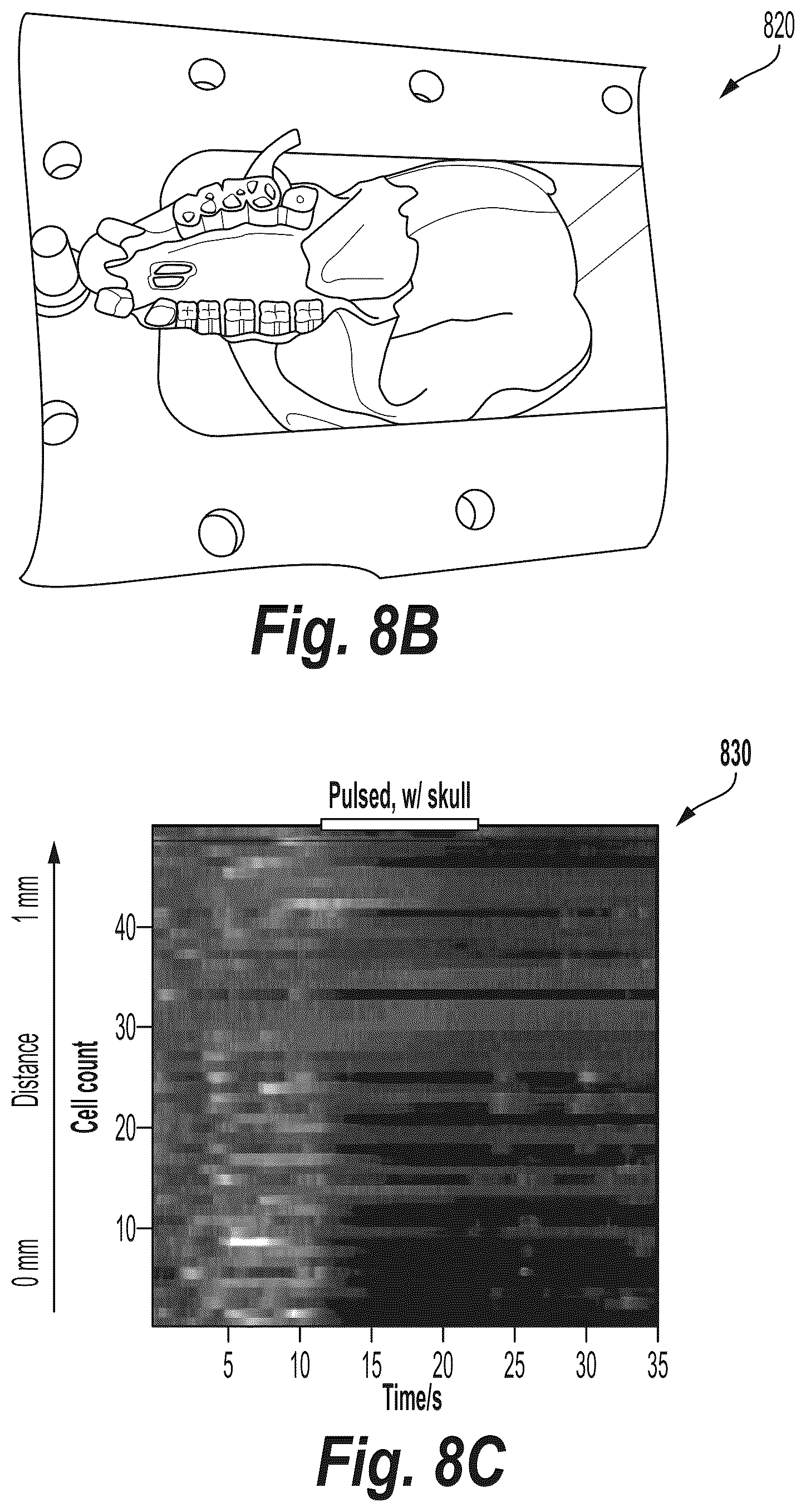 Patent US12318136 Figure 16 – Wireless neuromodulation via microwave split ring resonator