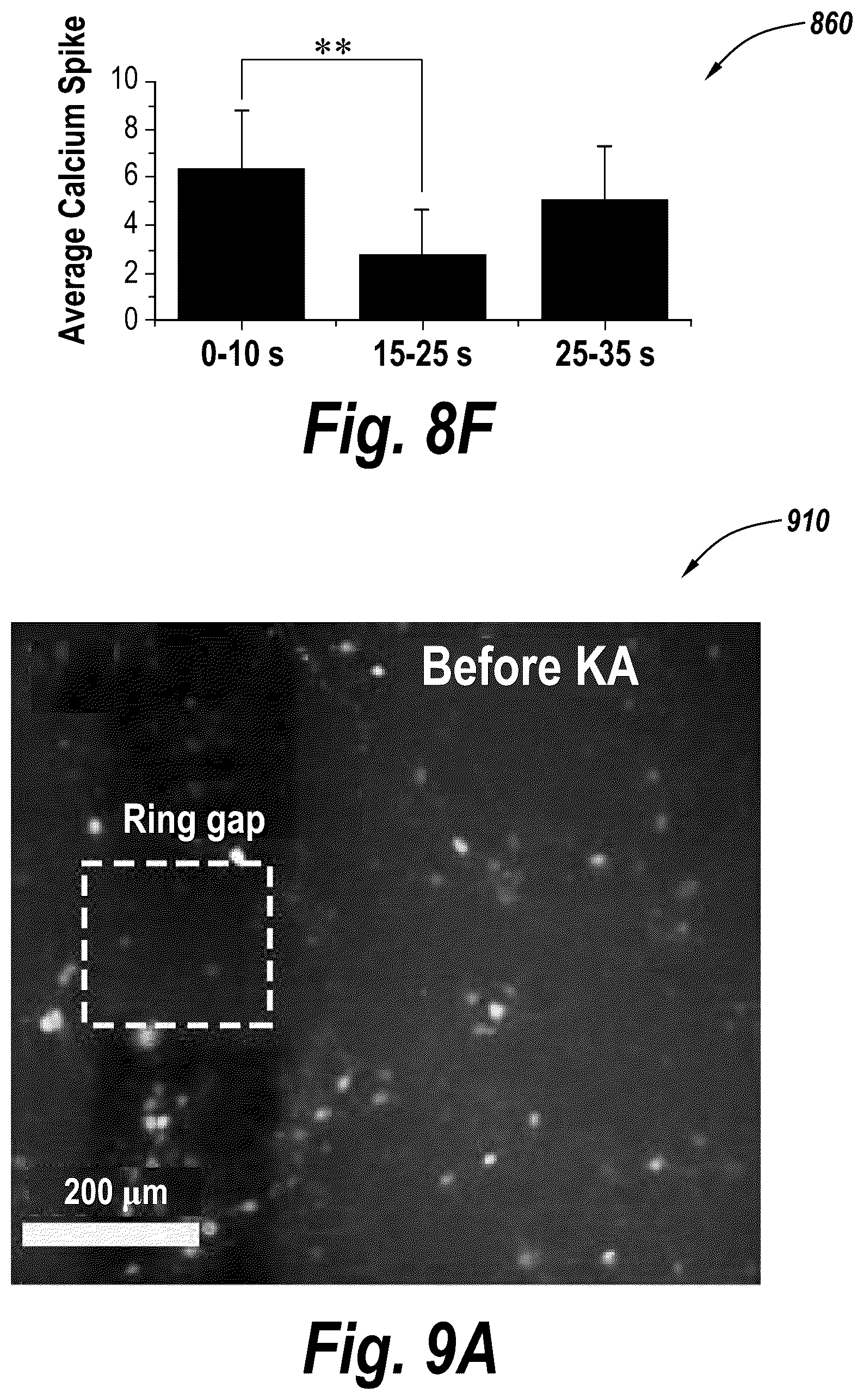 Patent US12318136 Figure 18 – Wireless neuromodulation via microwave split ring resonator