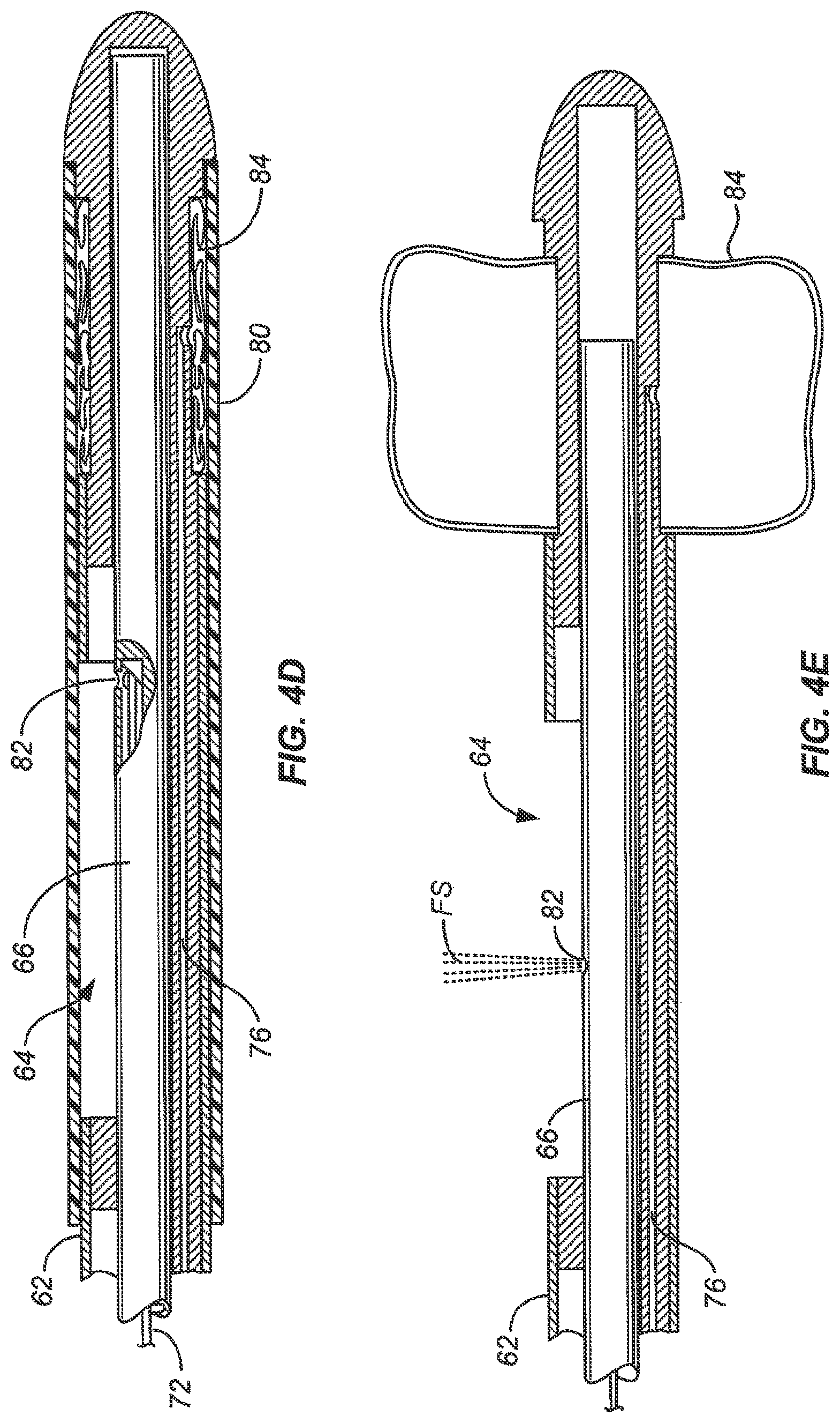 Patent US12318137 Figure 7 – Controlled tissue treatment with energy and control circuitry