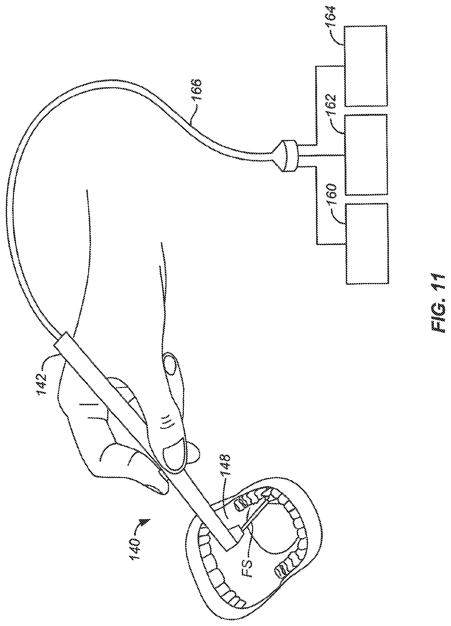Patent US12318137 Figure 11 – Controlled tissue treatment with energy and control circuitry