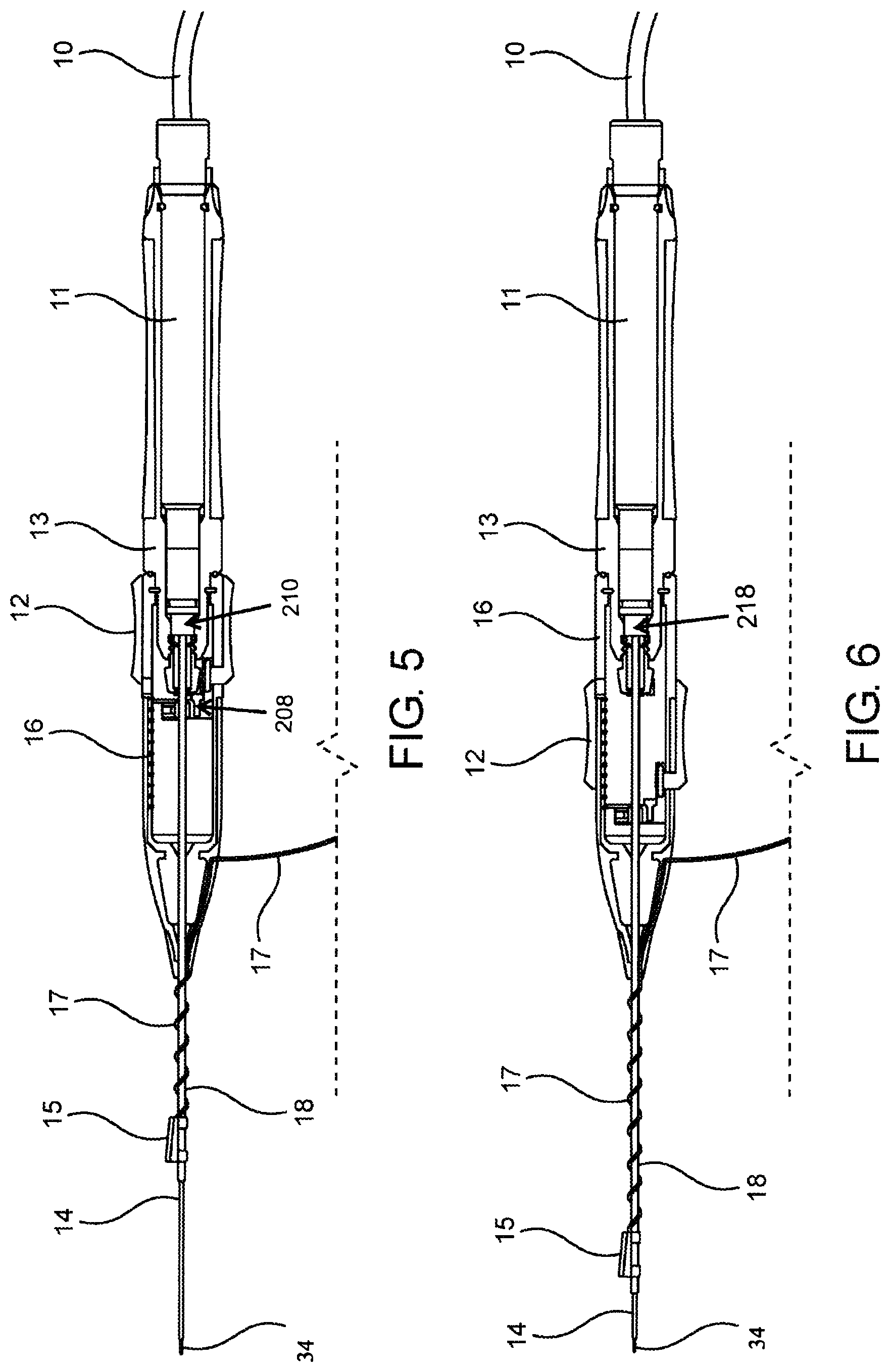 Patent US12318138 Figure 4 – Device and methods of laser treatment for rhinology