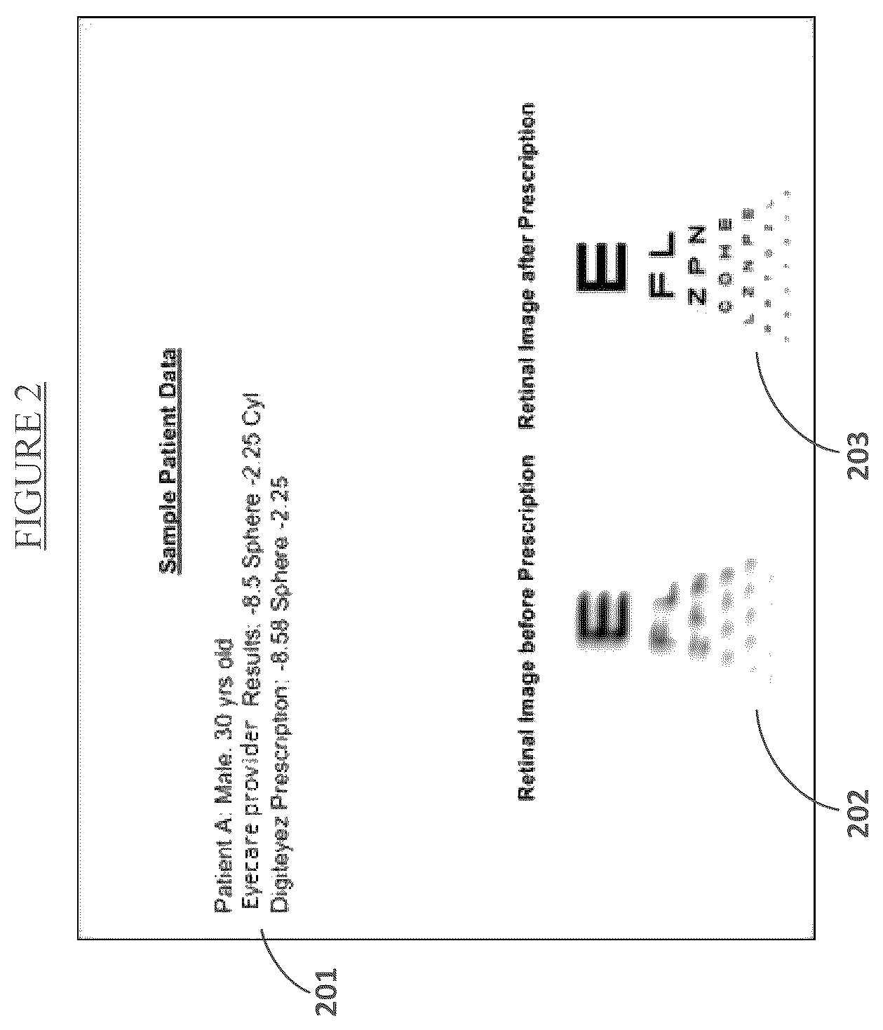 Patent US12318140 Figure 2 – System and method for determining prescription of corrective lenses using predictive calculations and corrected-eyesight simulation