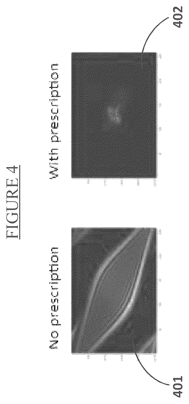 Patent US12318140 Figure 4 – System and method for determining prescription of corrective lenses using predictive calculations and corrected-eyesight simulation